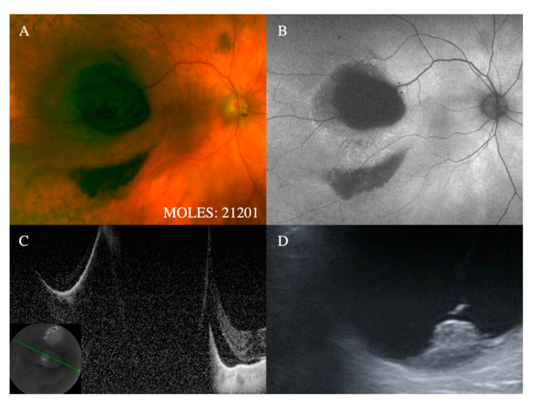Cancers 12 01311 g002