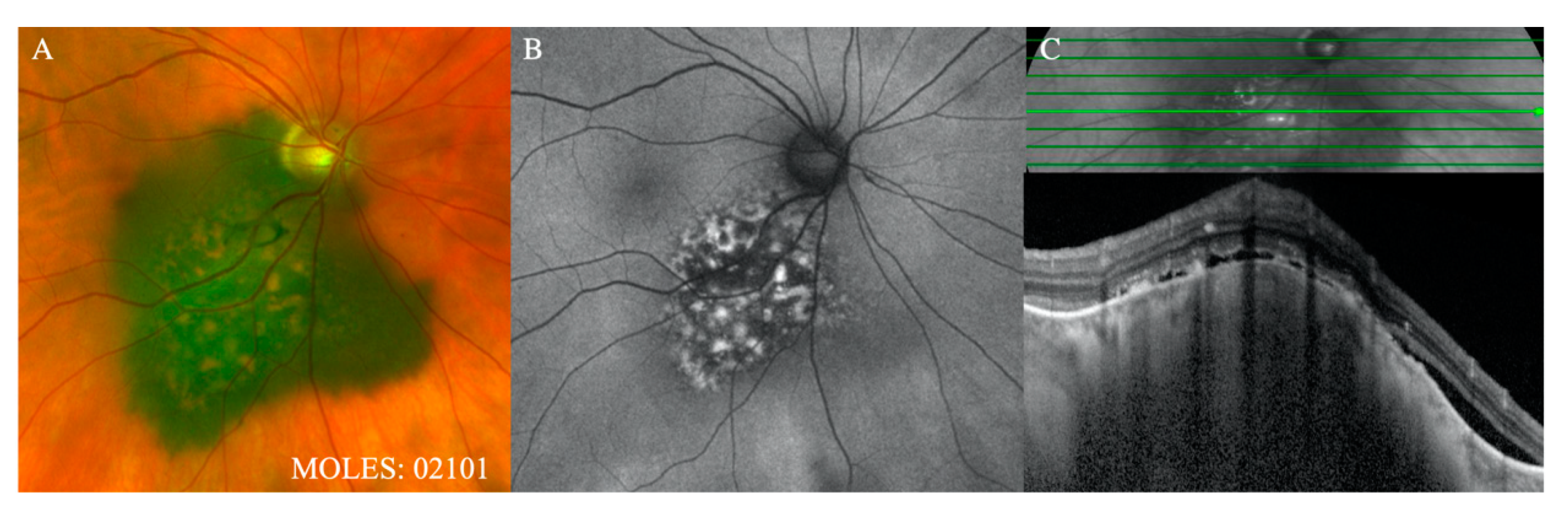 Cancers 12 01311 g003