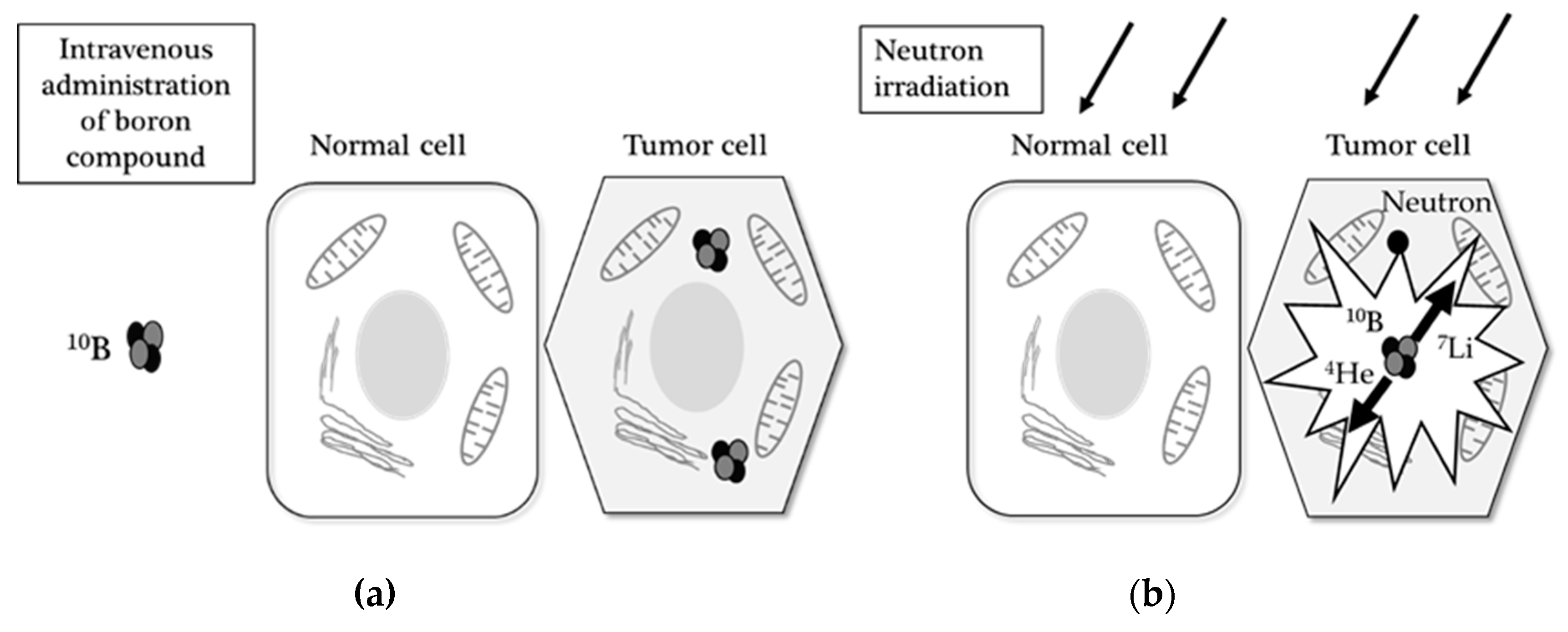 Cancers Free Full Text Boron Neutron Capture Therapy And Photodynamic Therapy For High Grade Meningiomas