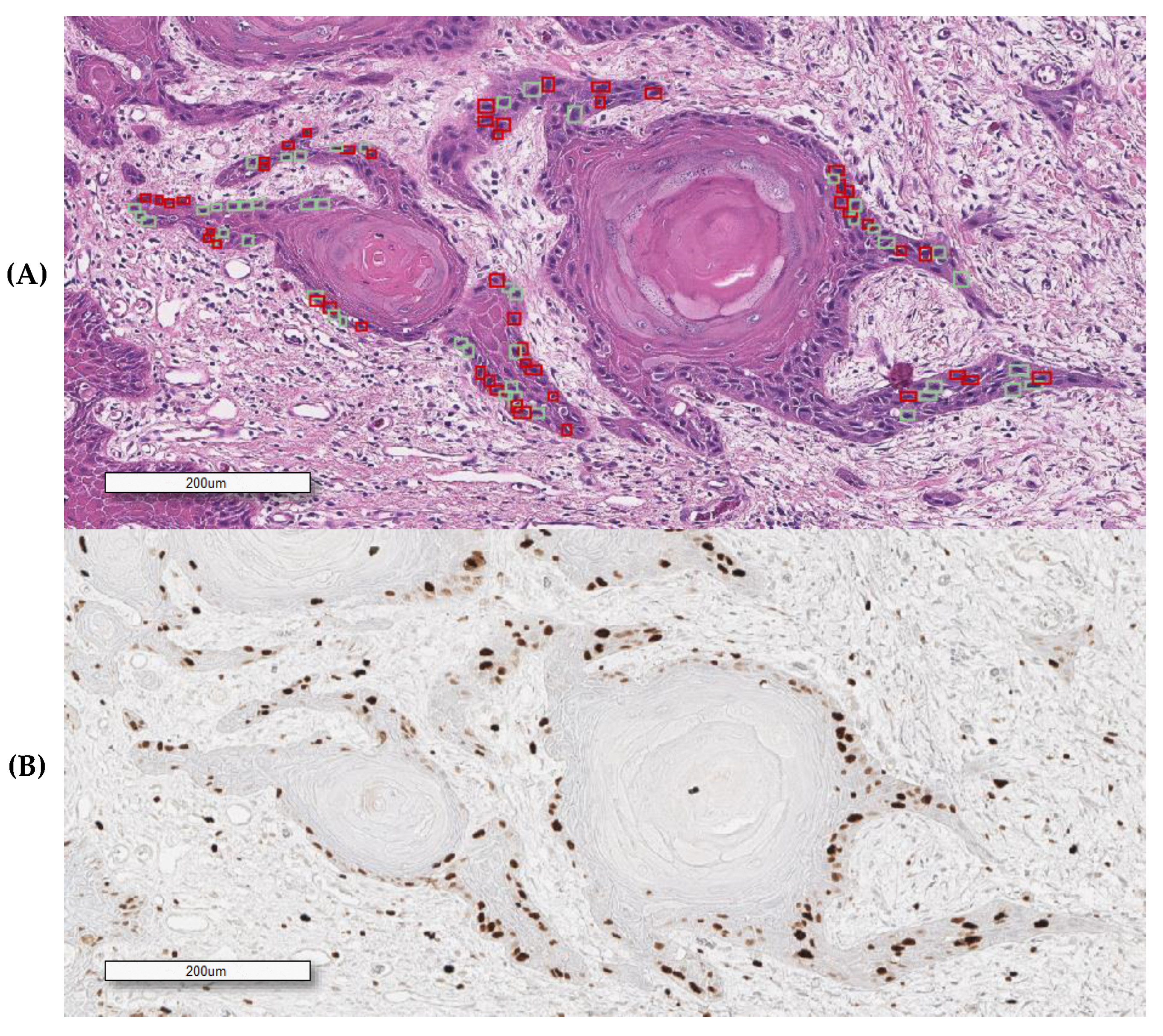 Cancers 12 01344 g002 Cancers 12 01344 g002