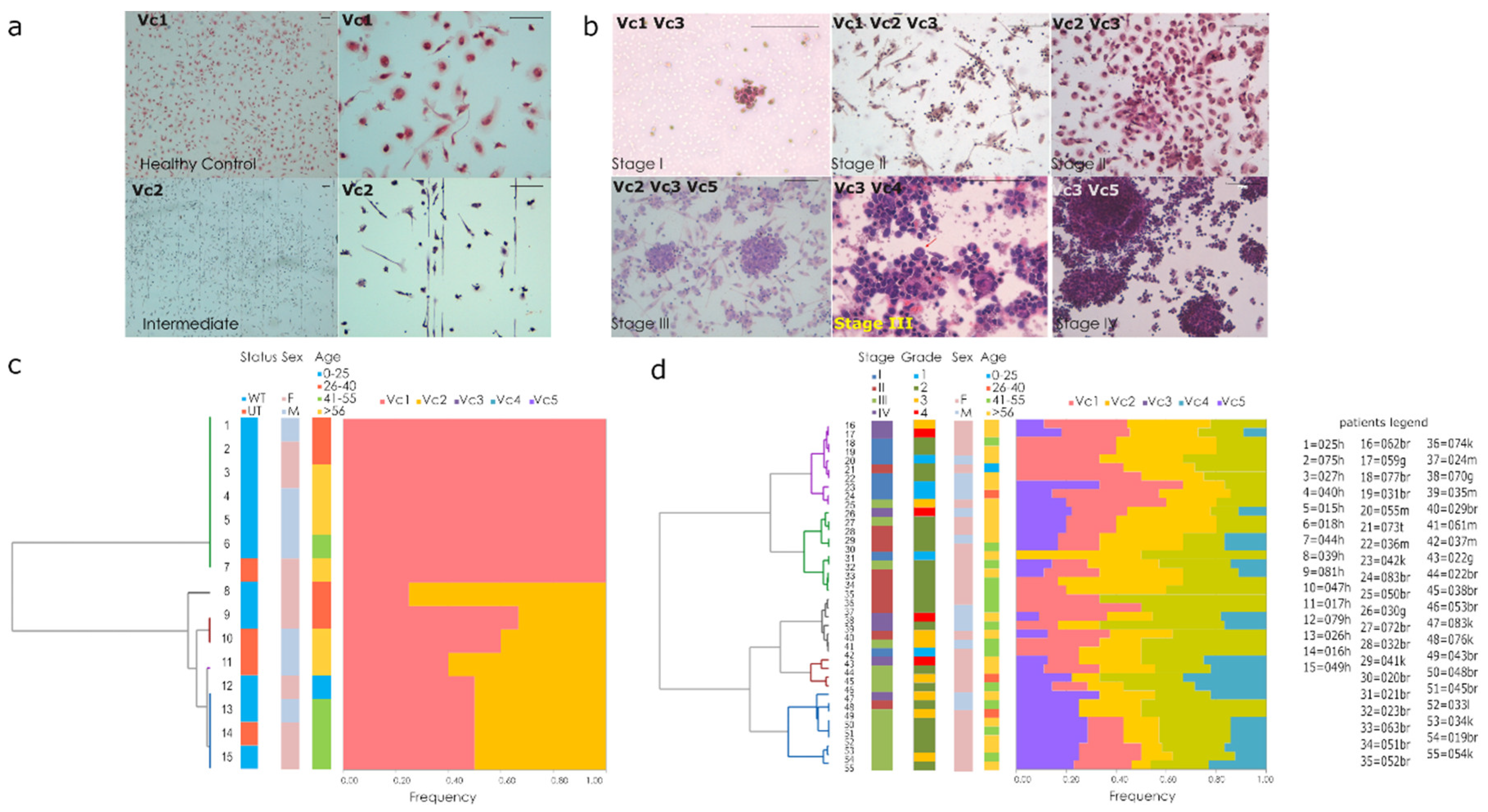Cancers 12 01362 g004