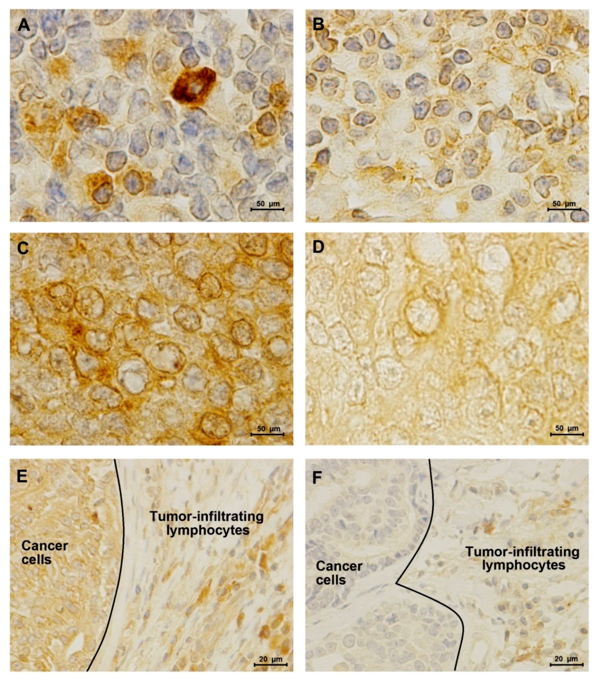 Cancers 12 01386 g004 Cancers 12 01386 g004