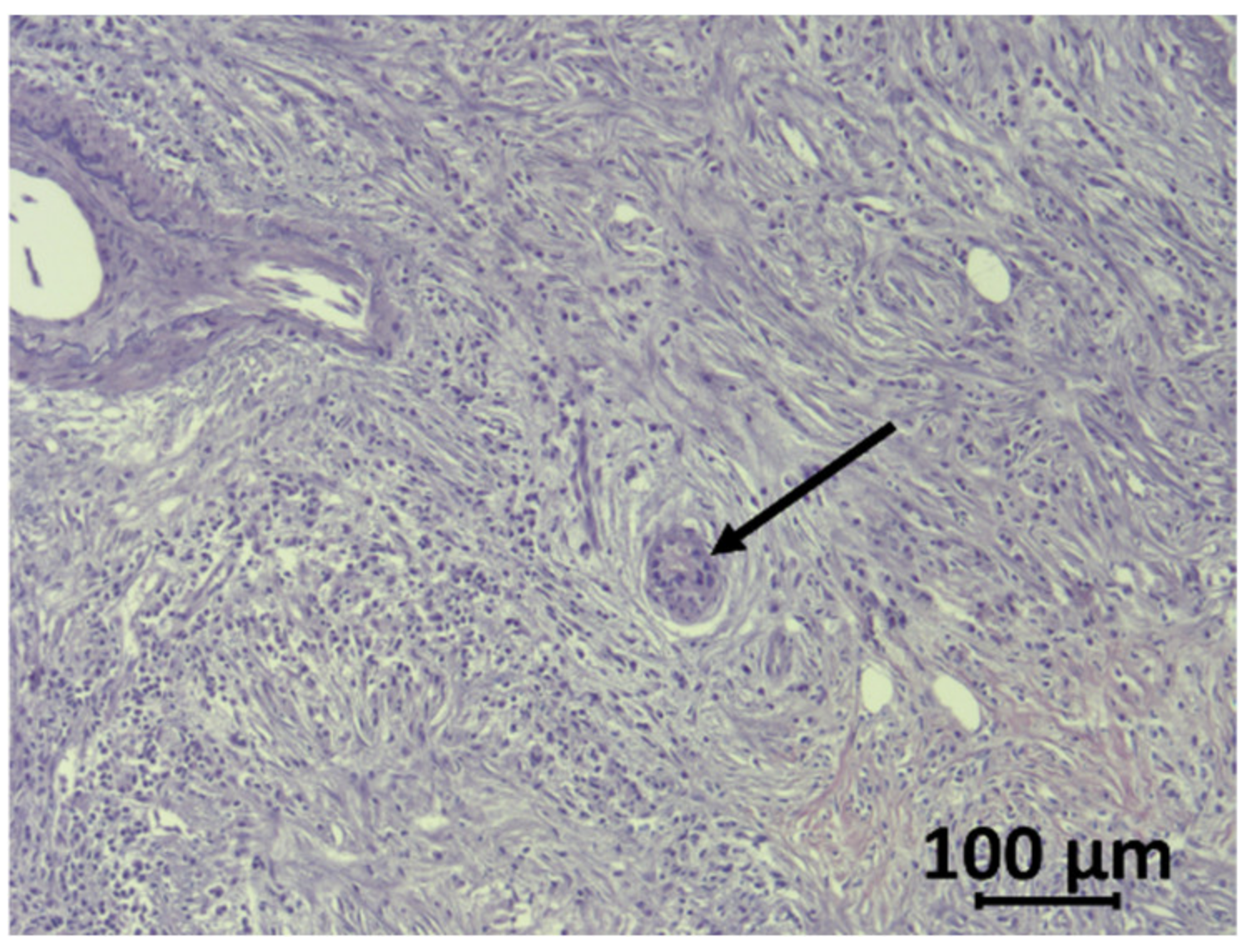Cancers 12 01389 g002 Cancers 12 01389 g002