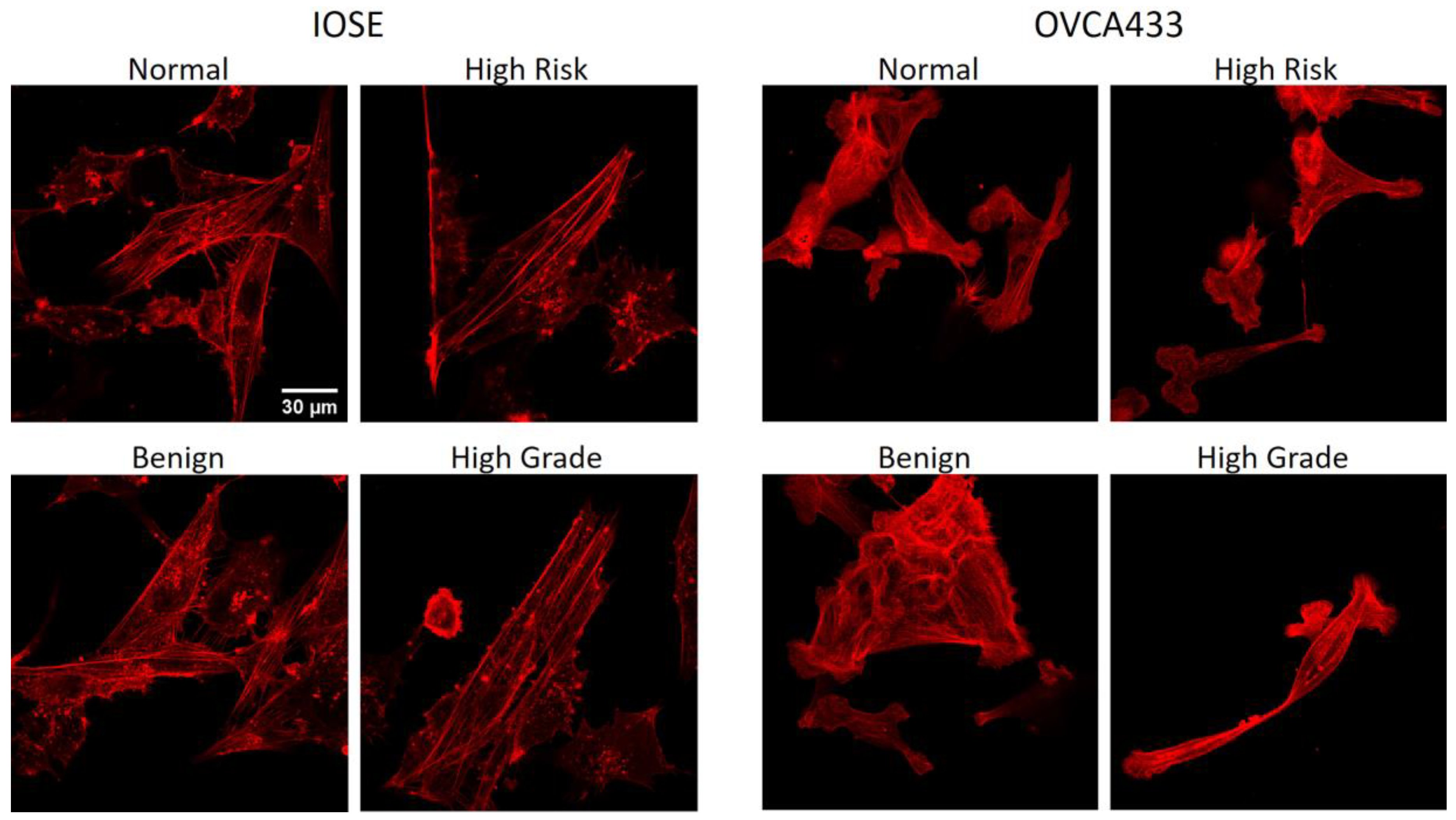 Cancers 12 01390 g008 Cancers 12 01390 g008