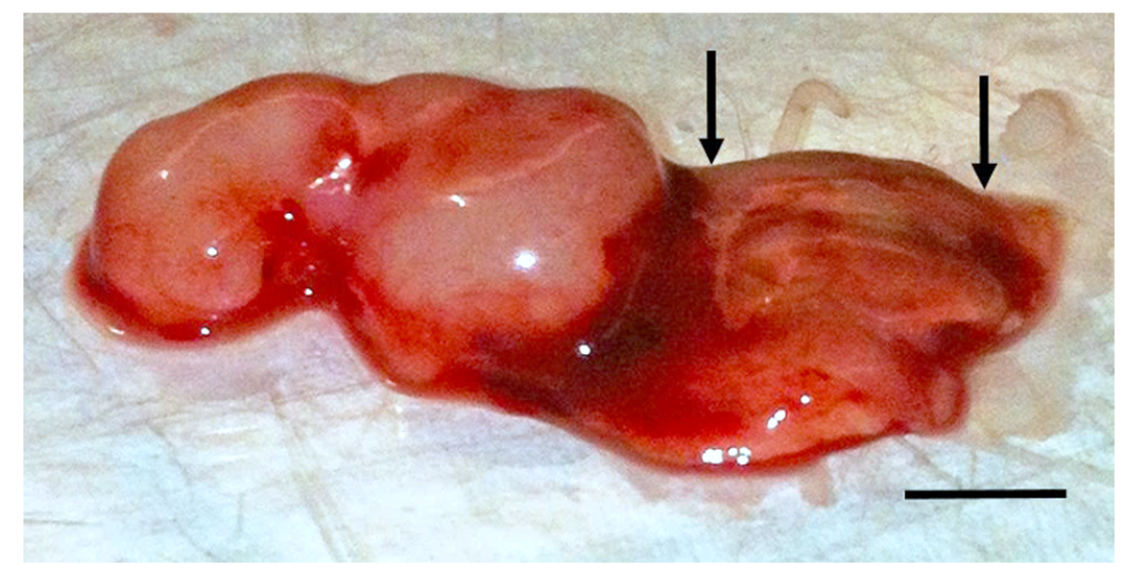 Cancers 12 01420 g001