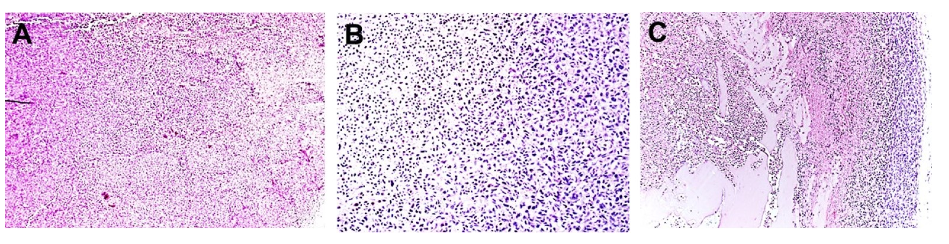 Cancers 12 01420 g006