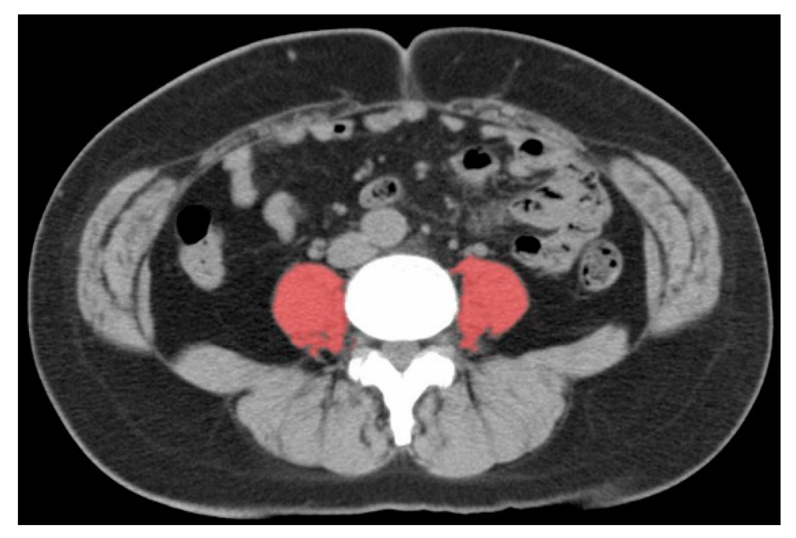 Cancers 12 01465 g002