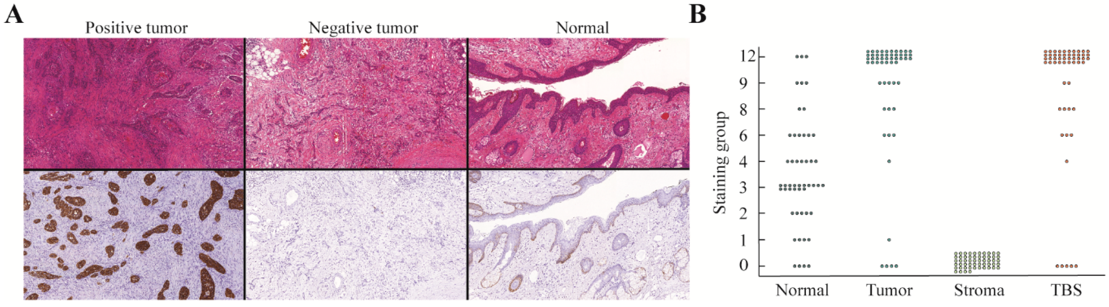 Cancers 12 01474 g002