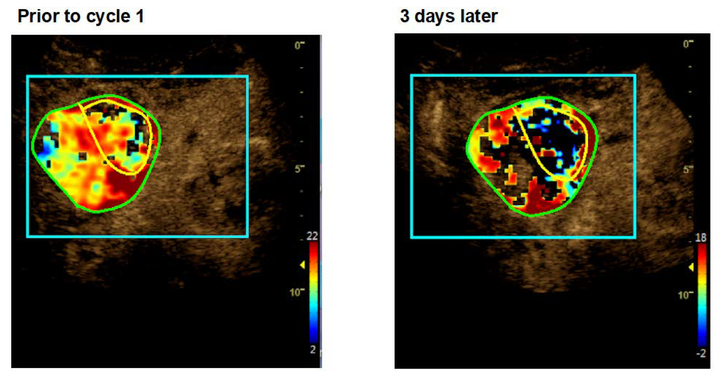Cancers 12 01488 g003 Cancers 12 01488 g003
