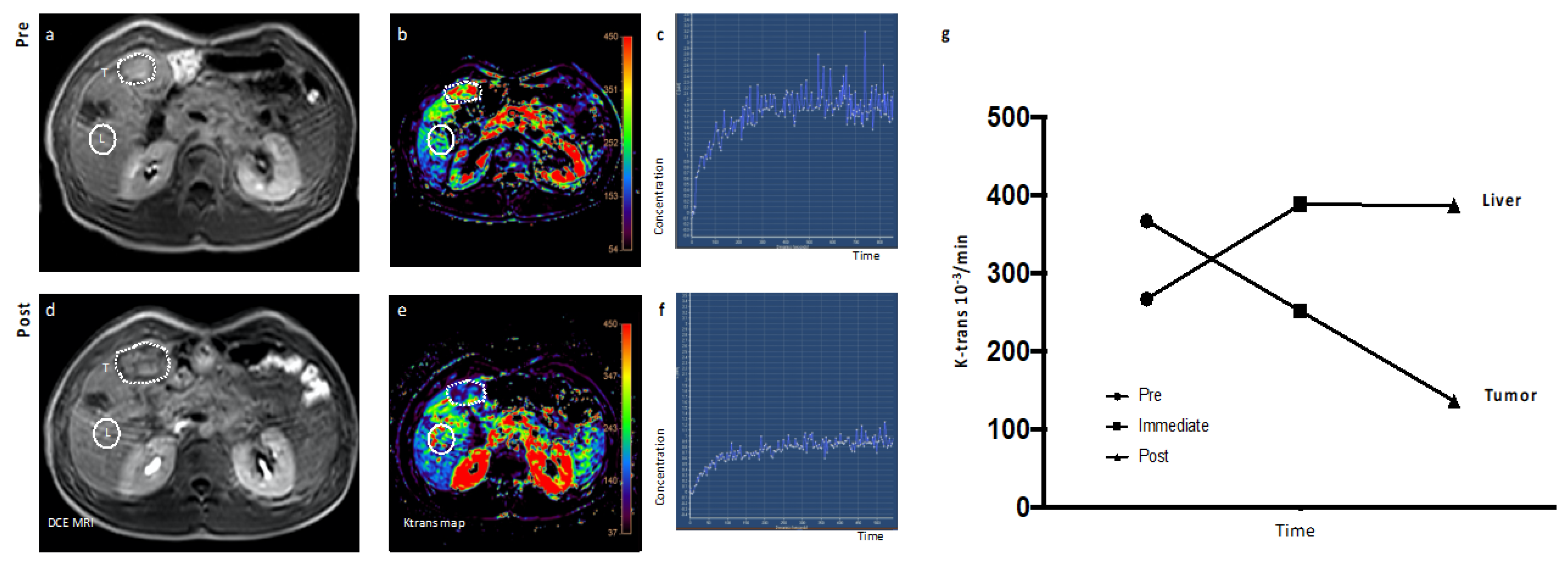 Cancers 12 01488 g004 Cancers 12 01488 g004