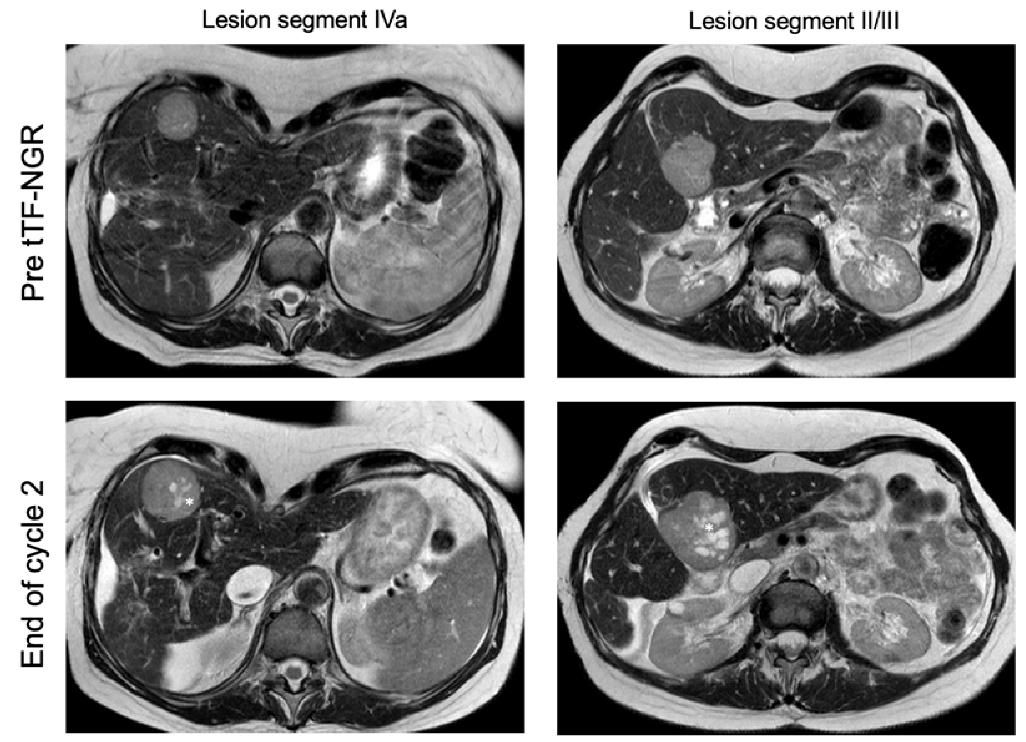 Cancers 12 01488 g006 Cancers 12 01488 g006