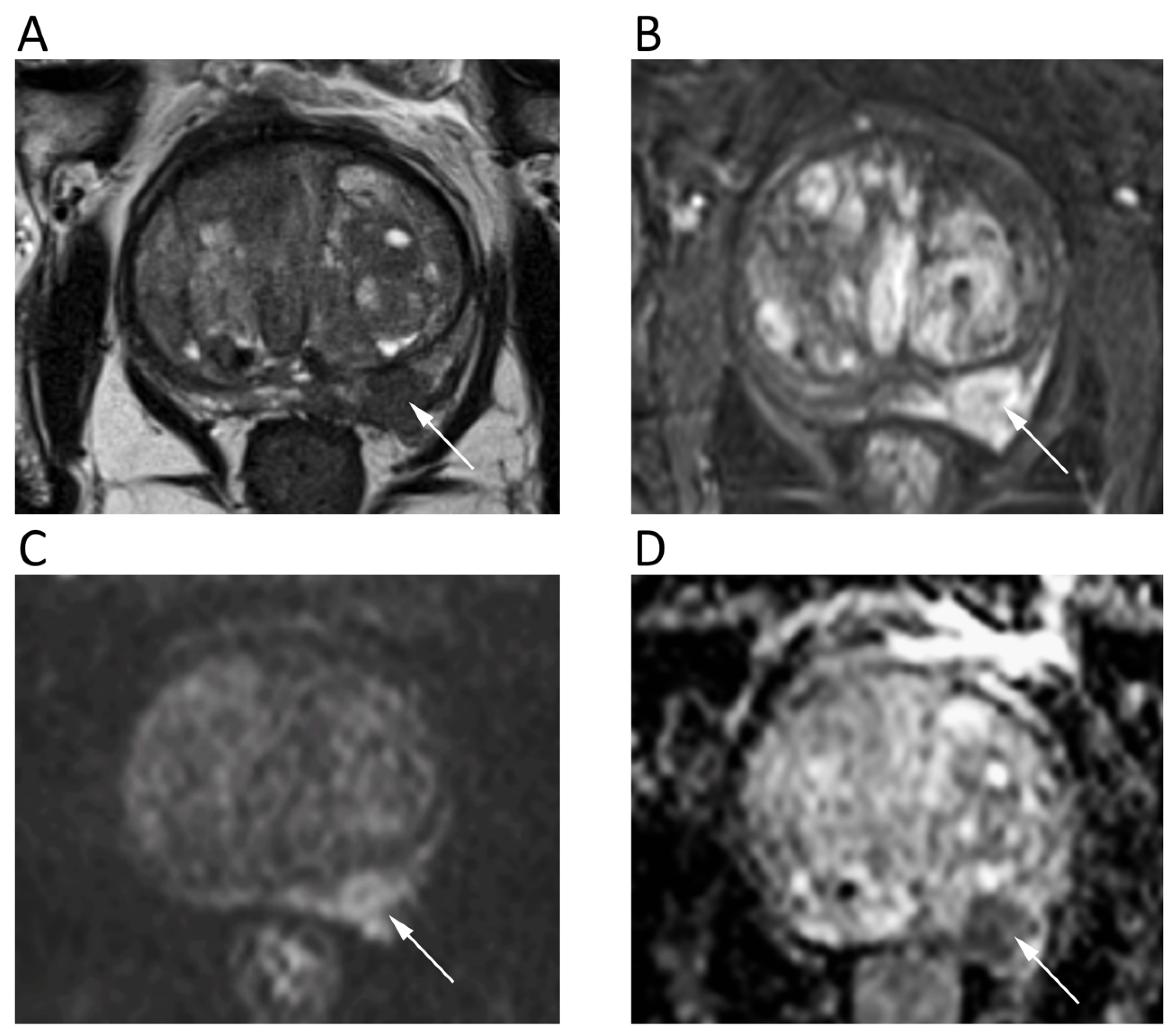 Cancers 12 01493 g010 Cancers 12 01493 g010