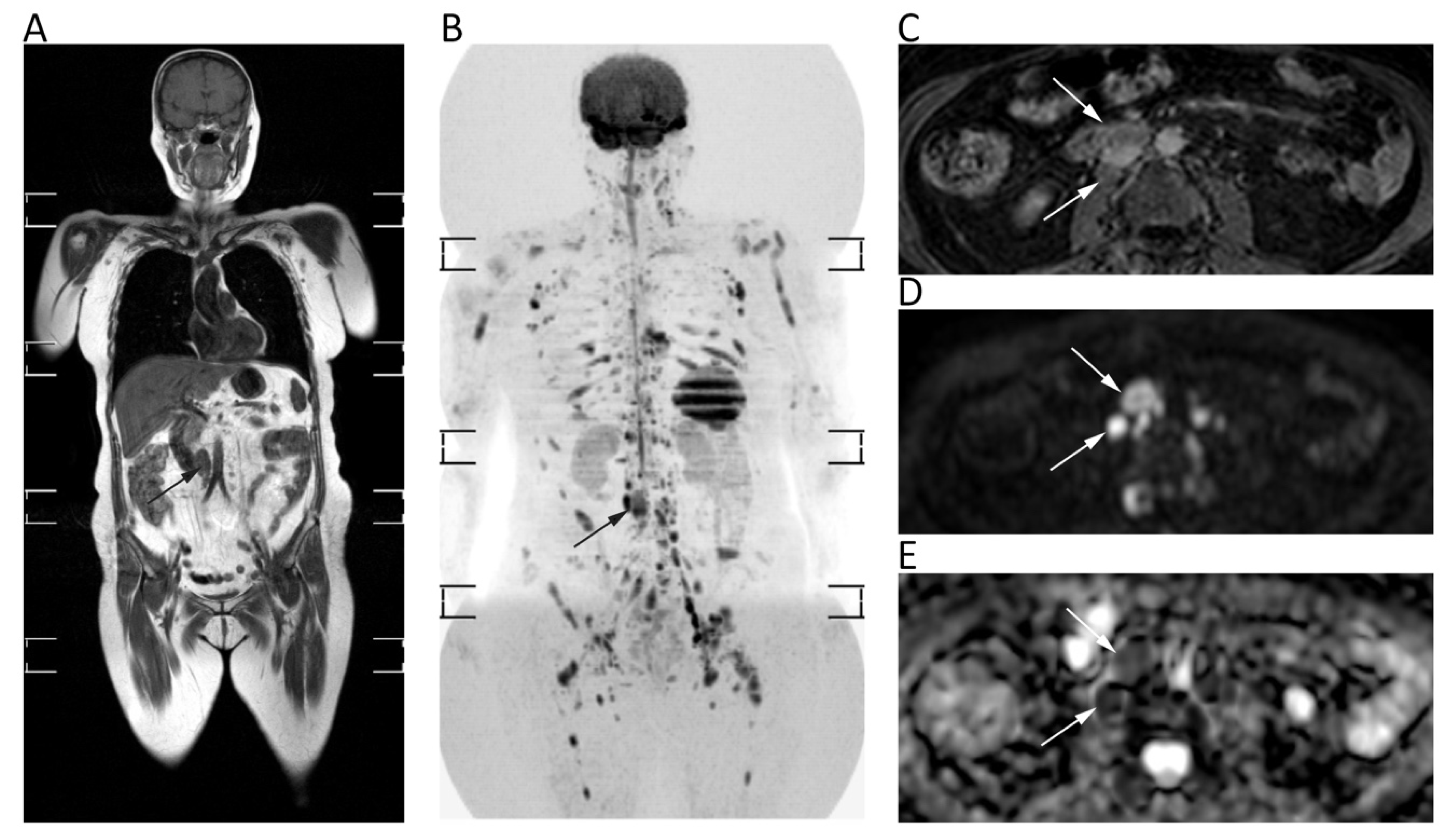 Cancers 12 01493 g011 Cancers 12 01493 g011