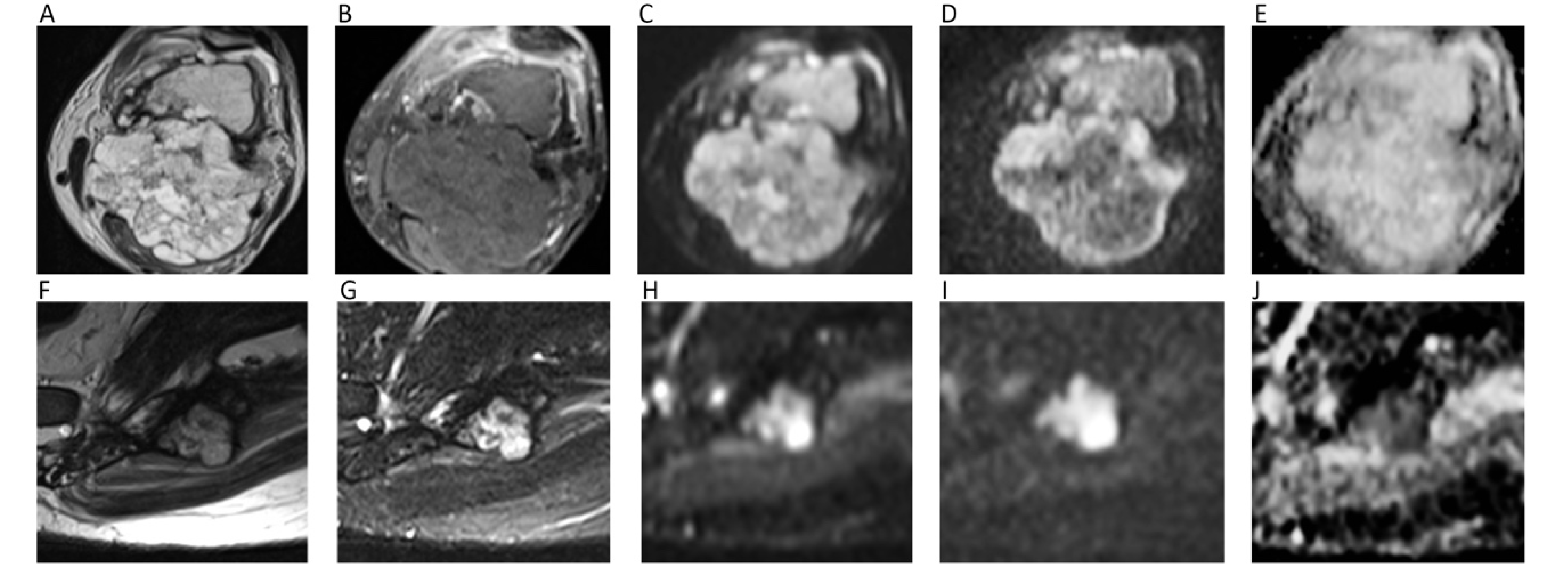 Cancers 12 01493 g012 Cancers 12 01493 g012