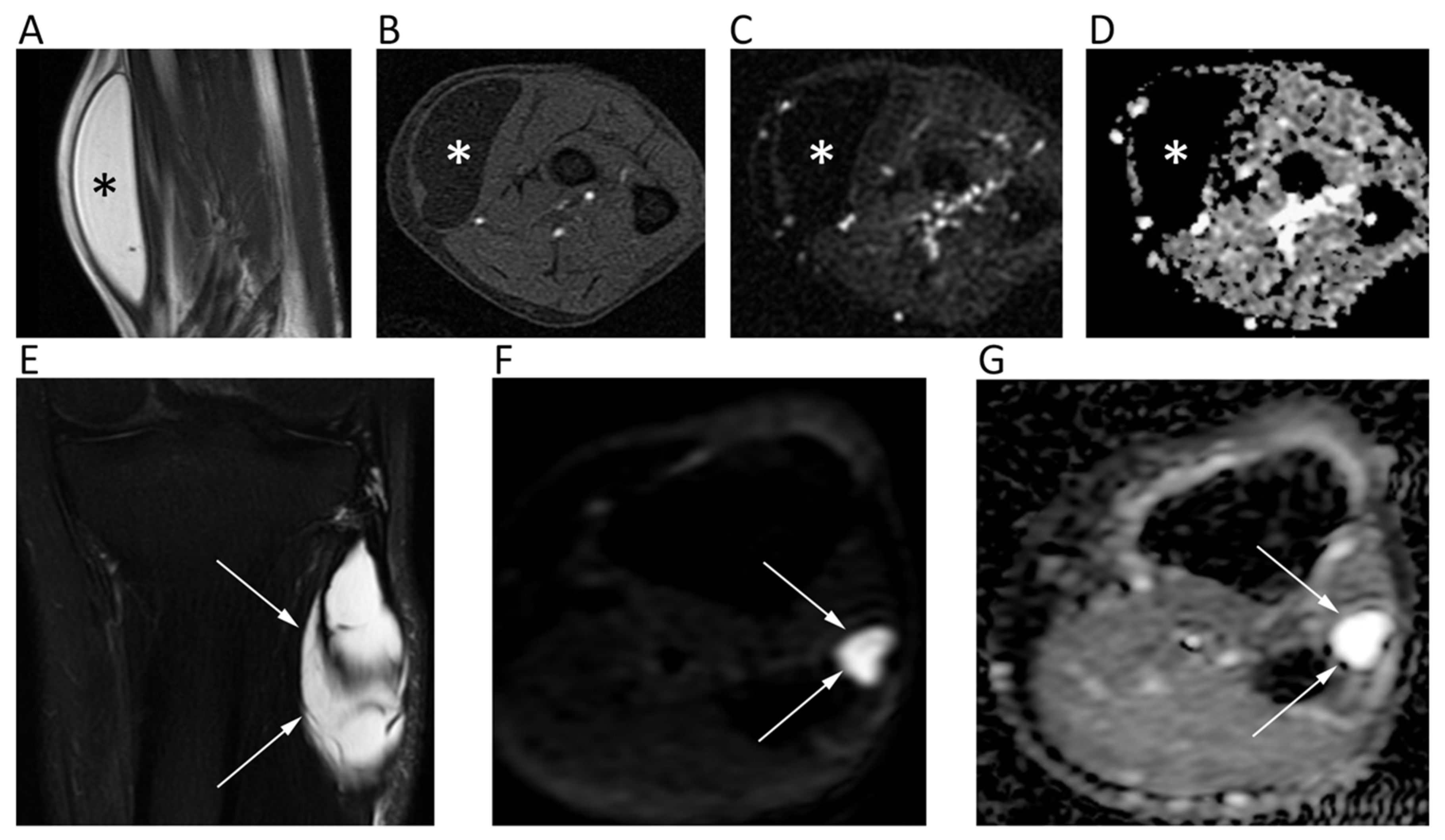 Cancers 12 01493 g013 Cancers 12 01493 g013