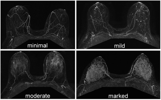 Cancers Free Full Text Current Landscape Of Breast Cancer Imaging And Potential Quantitative Imaging Markers Of Response In Er Positive Breast Cancers Treated With Neoadjuvant Therapy Html