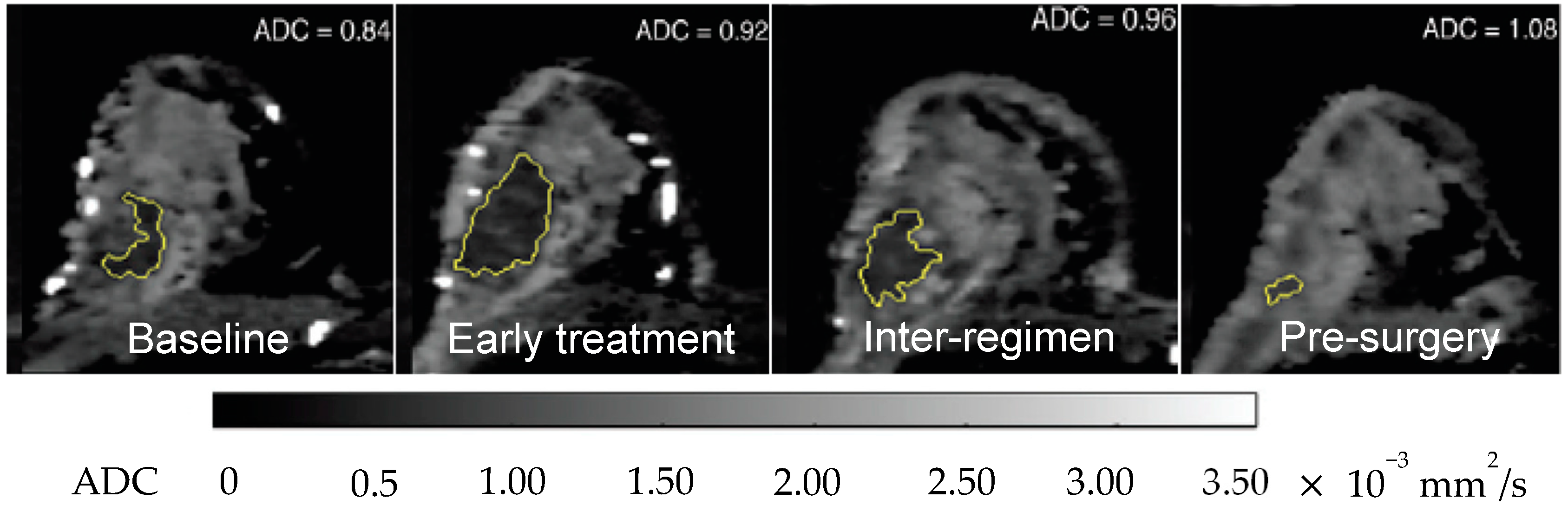 Cancers 12 01511 g005 Cancers 12 01511 g005