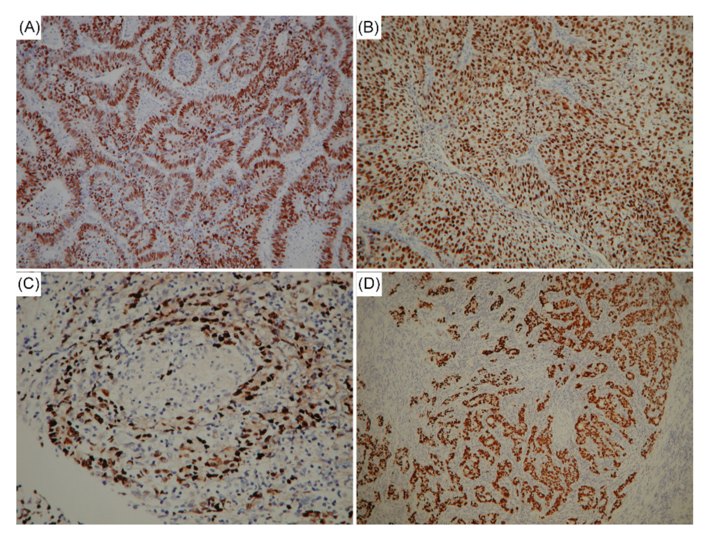 Cancers 12 01517 g001 Cancers 12 01517 g001