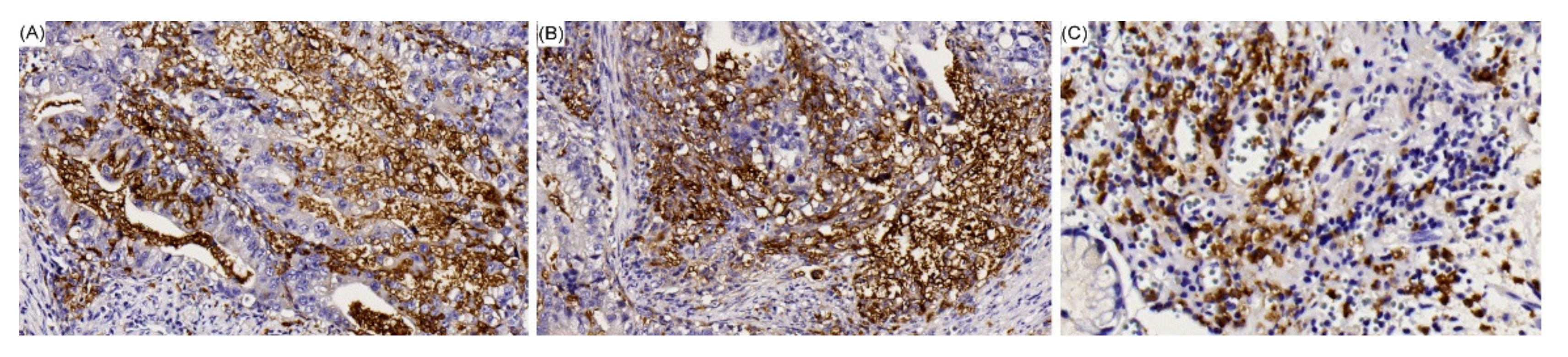 Cancers 12 01517 g002 Cancers 12 01517 g002