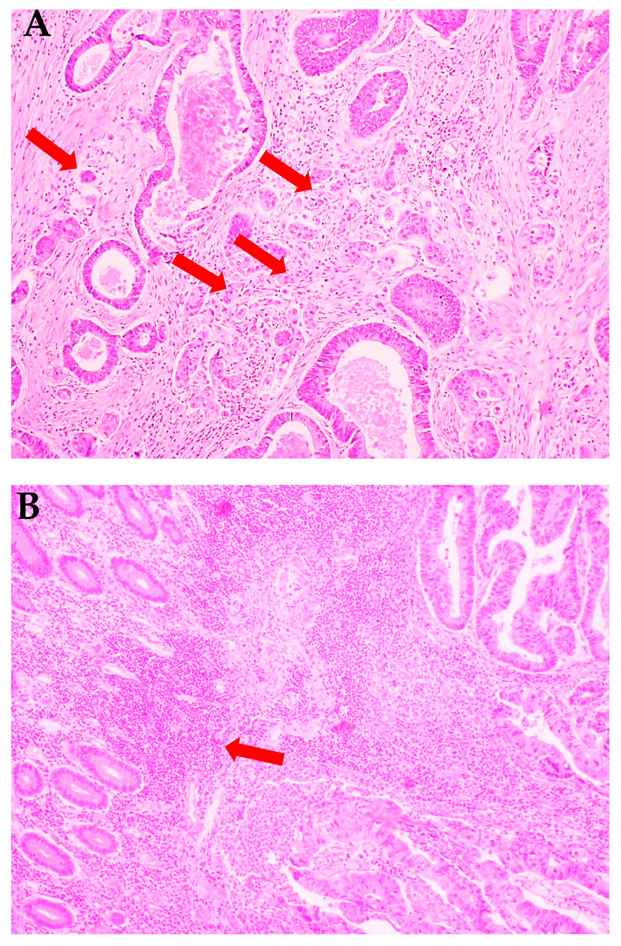 Cancers 12 01636 g001 Cancers 12 01636 g001