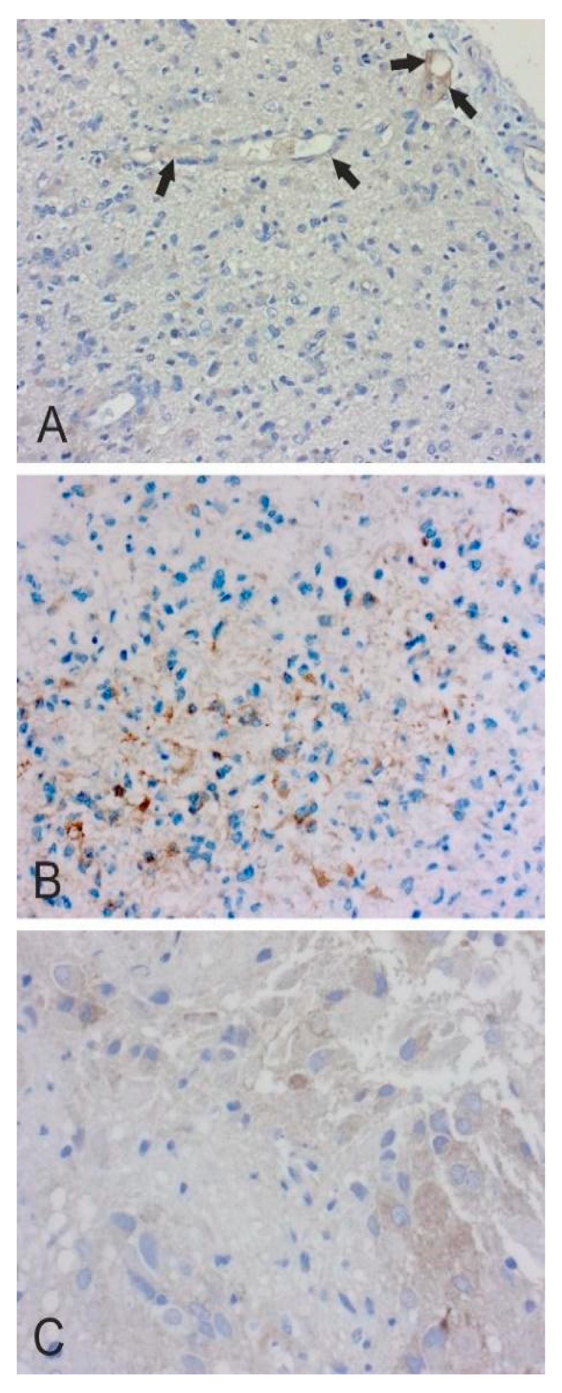 Cancers 12 01723 g002 Cancers 12 01723 g002