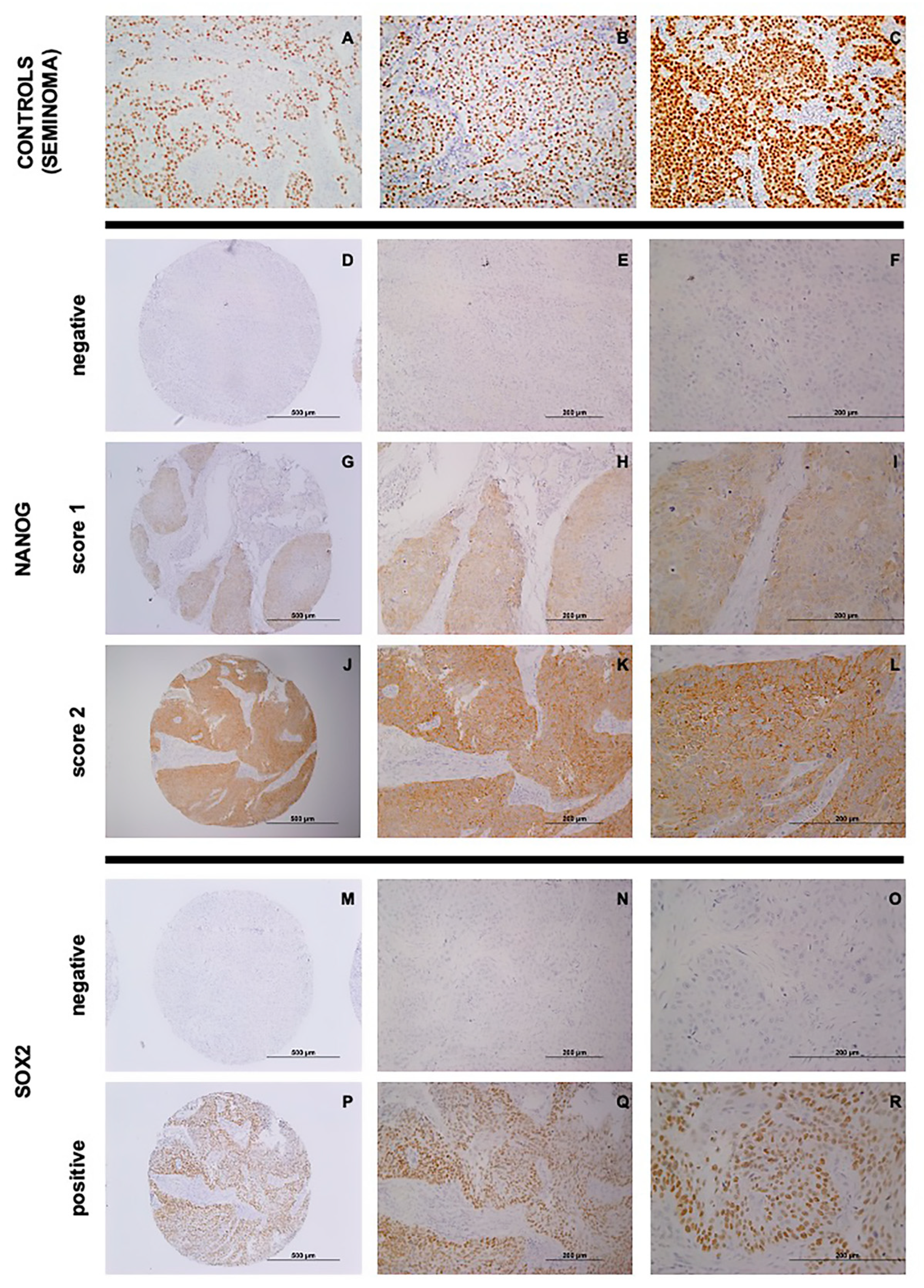 Cancers 12 01794 g001 Cancers 12 01794 g001