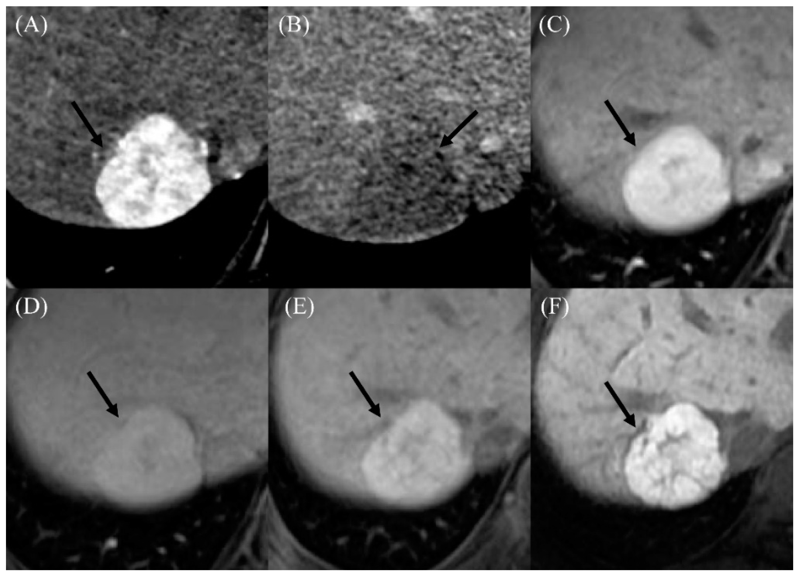 Cancers 12 01805 g003 Cancers 12 01805 g003