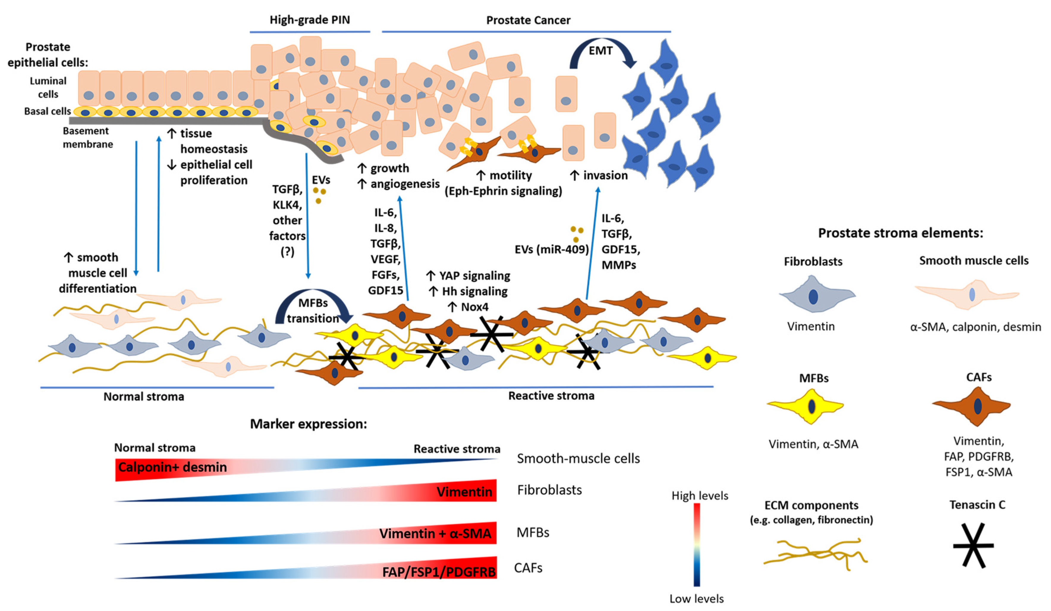 Cancers | Free Full-Text | The Role of Cancer-Associated ...