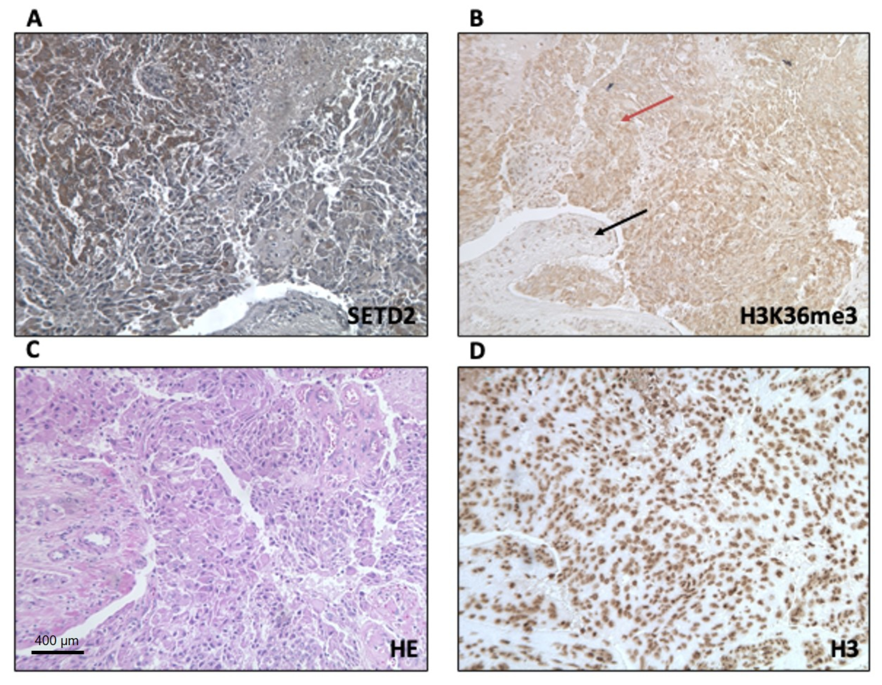 Cancers 12 01892 g003