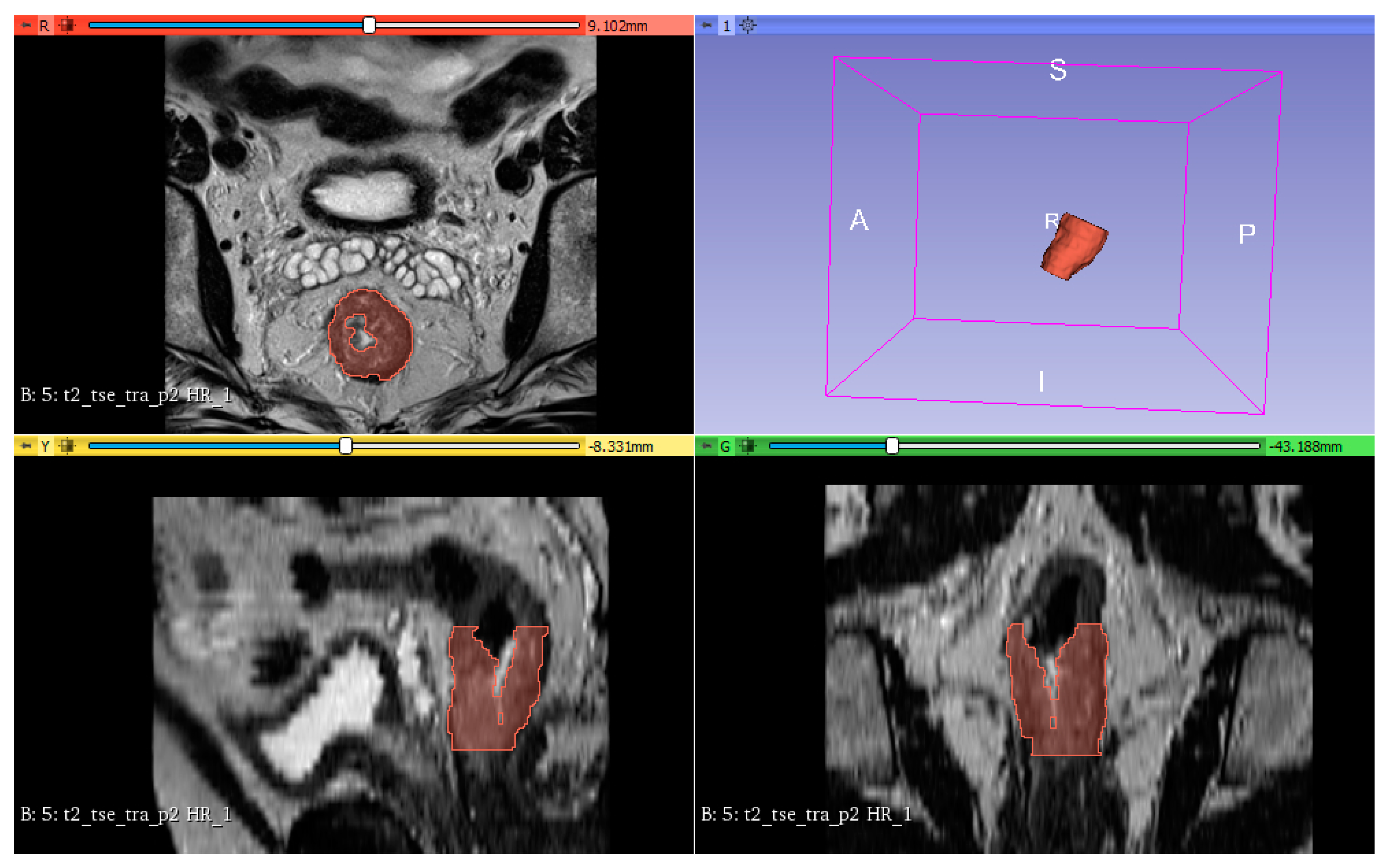 Cancers 12 01894 g005