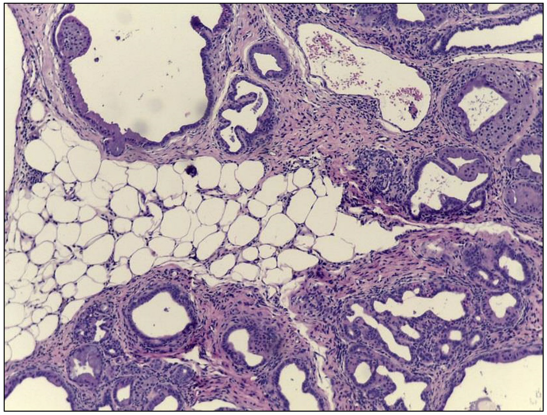 Cancers 12 01946 g002