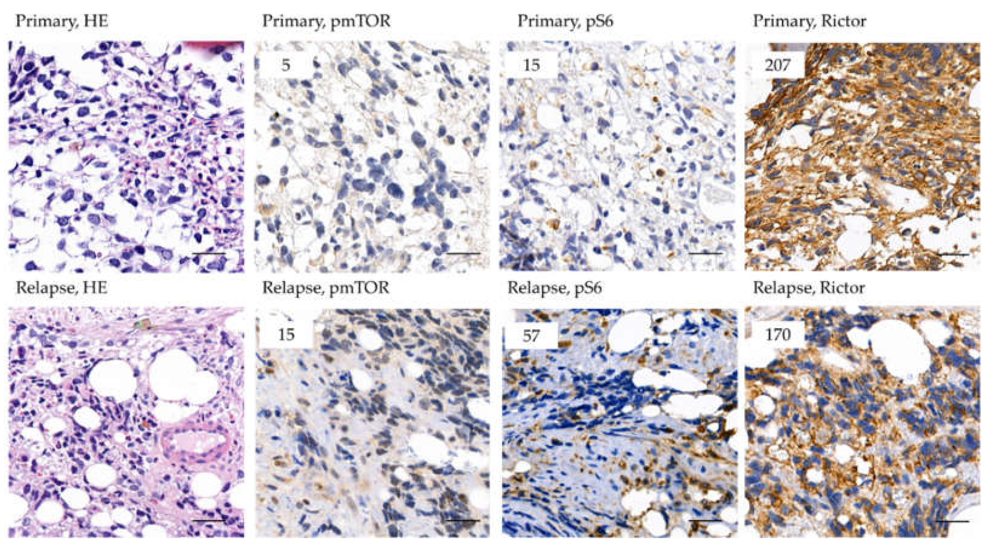 Cancers 12 01947 g007 Cancers 12 01947 g007