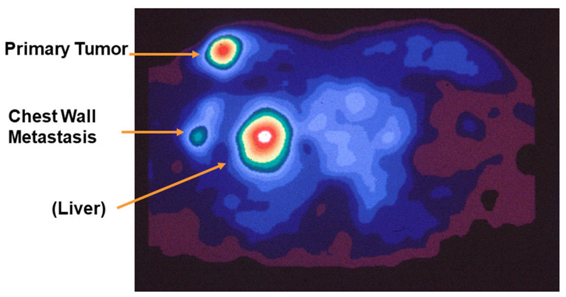 Cancers 12 02020 g006 Cancers 12 02020 g006