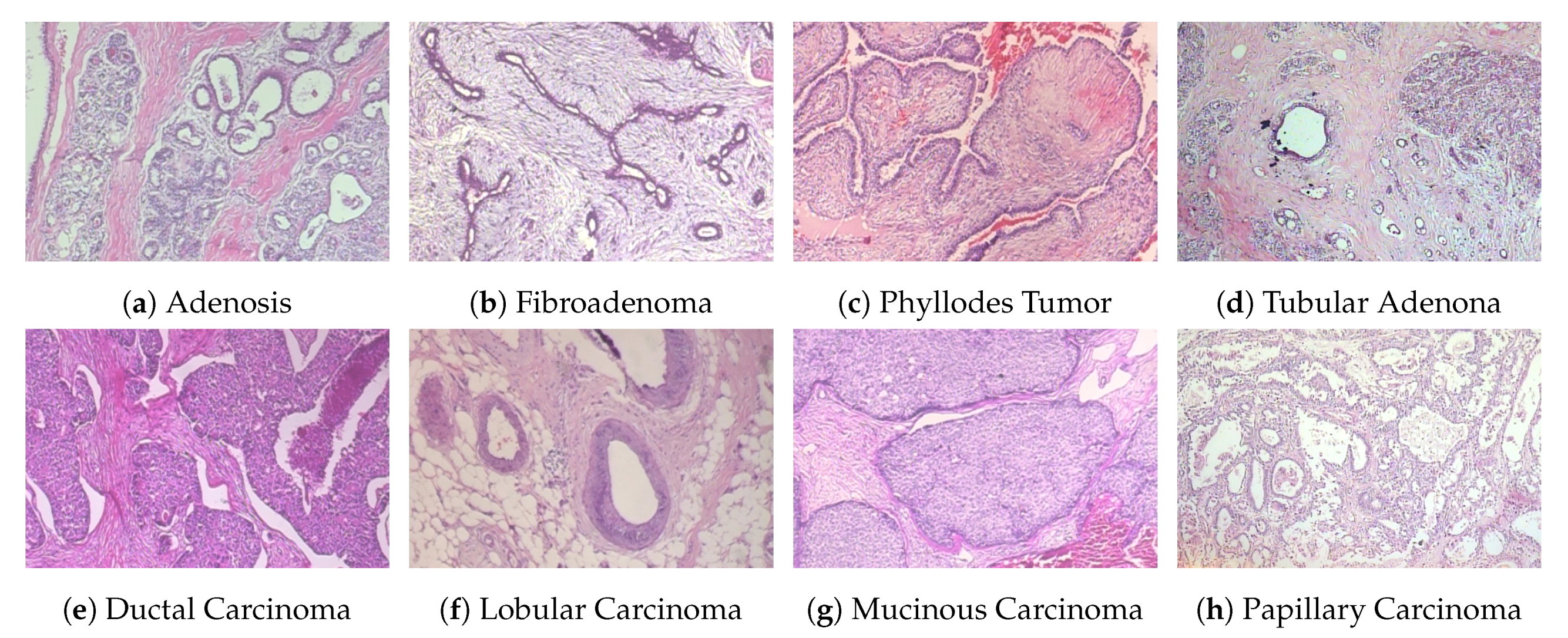 Cancers 12 02031 g003
