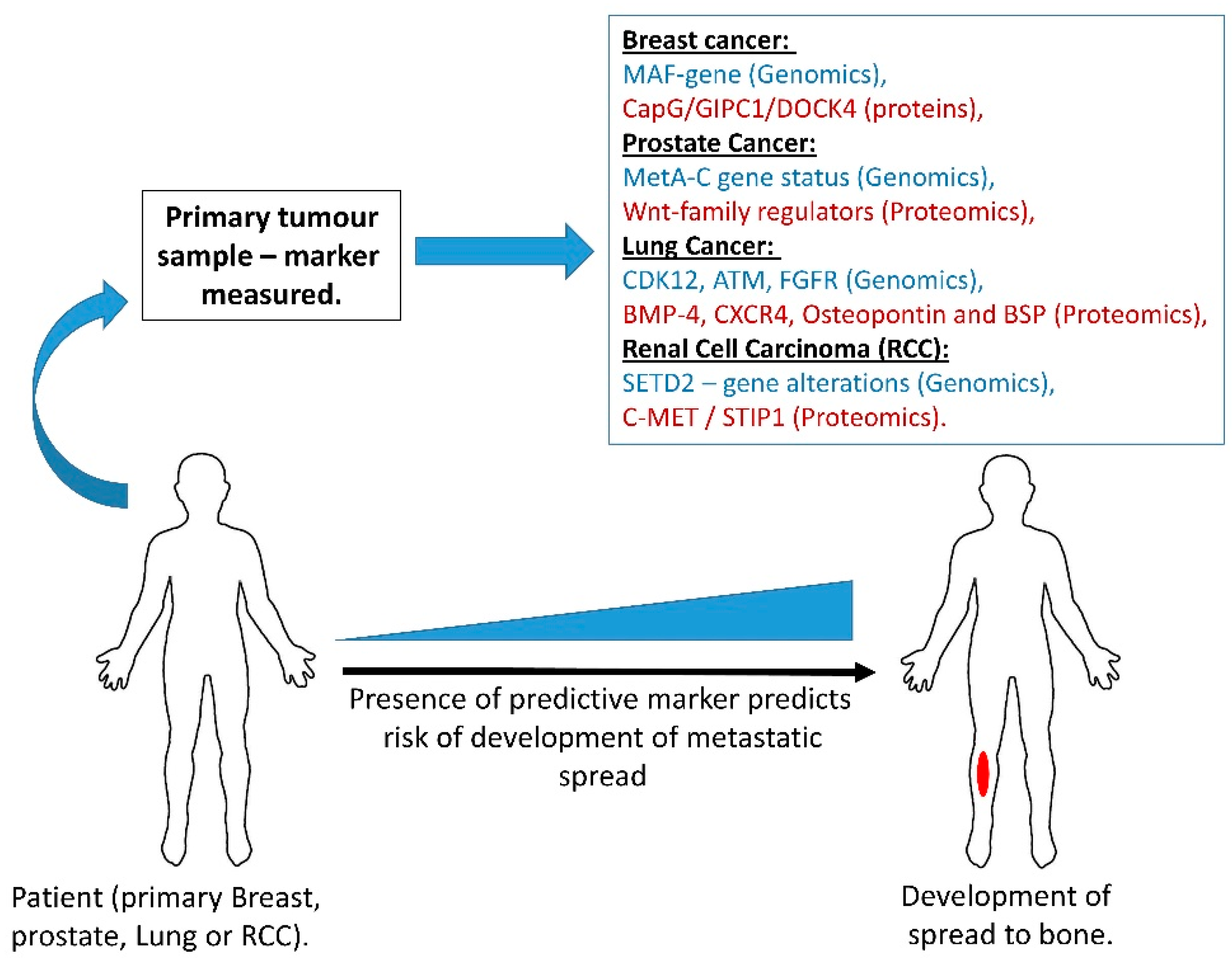 predicting prostate cancer metastasis)