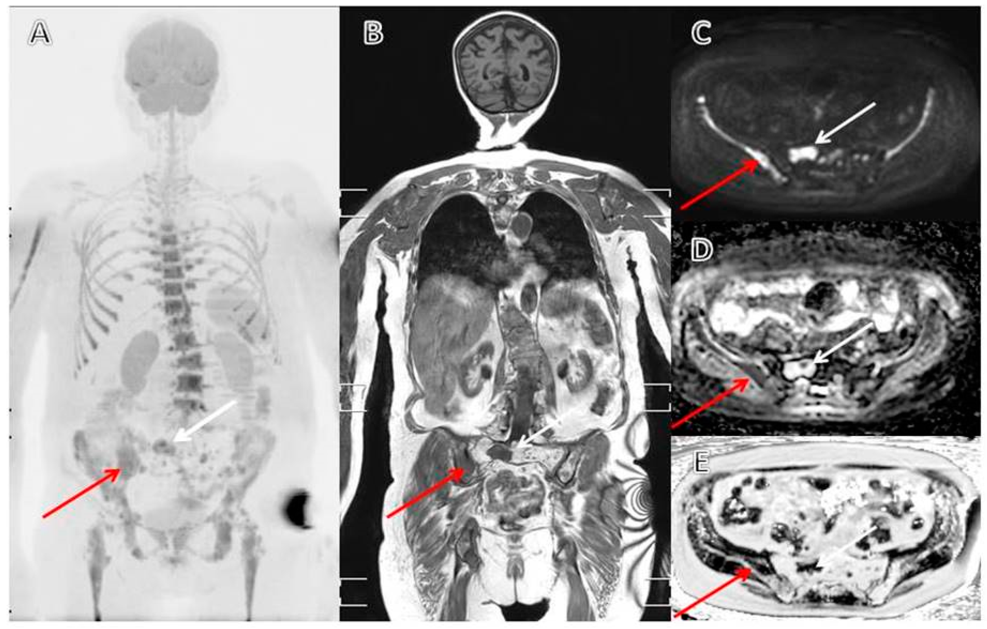 Cancers 12 02113 g003 Cancers 12 02113 g003