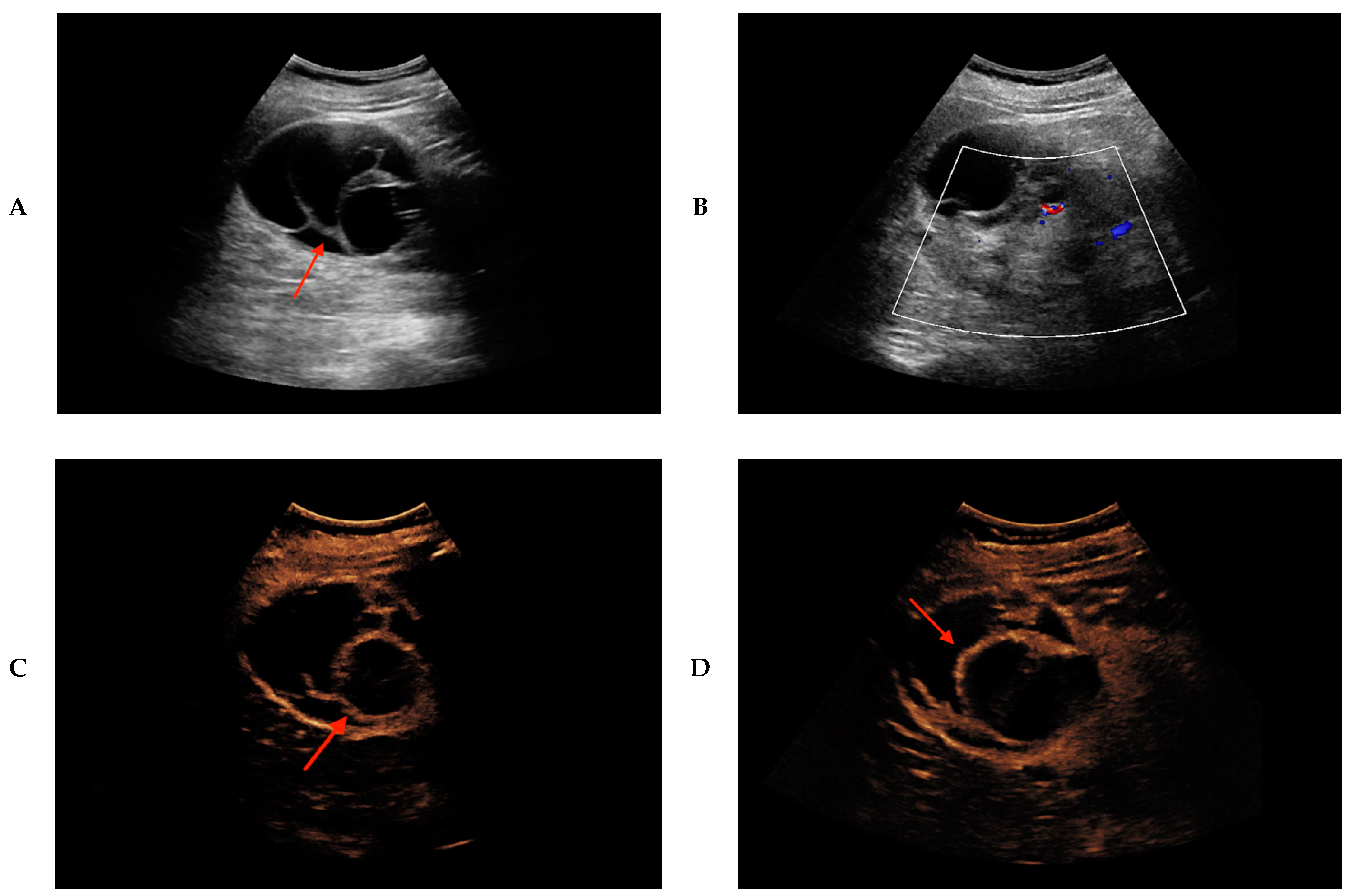 Cancers 12 02170 g002a