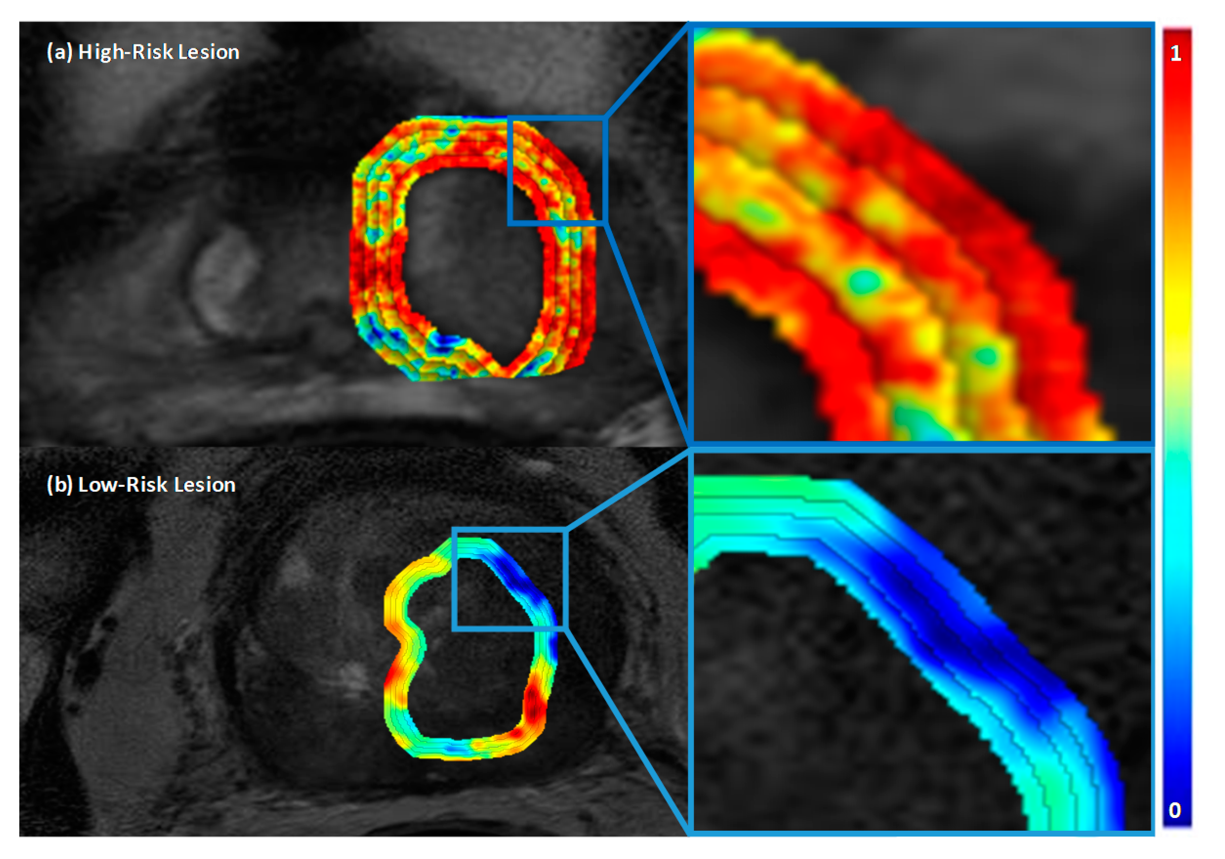Cancers 12 02200 g001