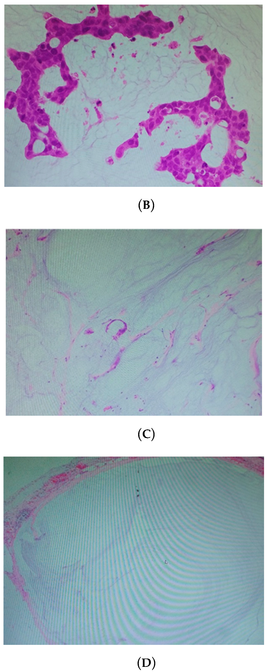 Cancers 12 02212 g004b Cancers 12 02212 g004b