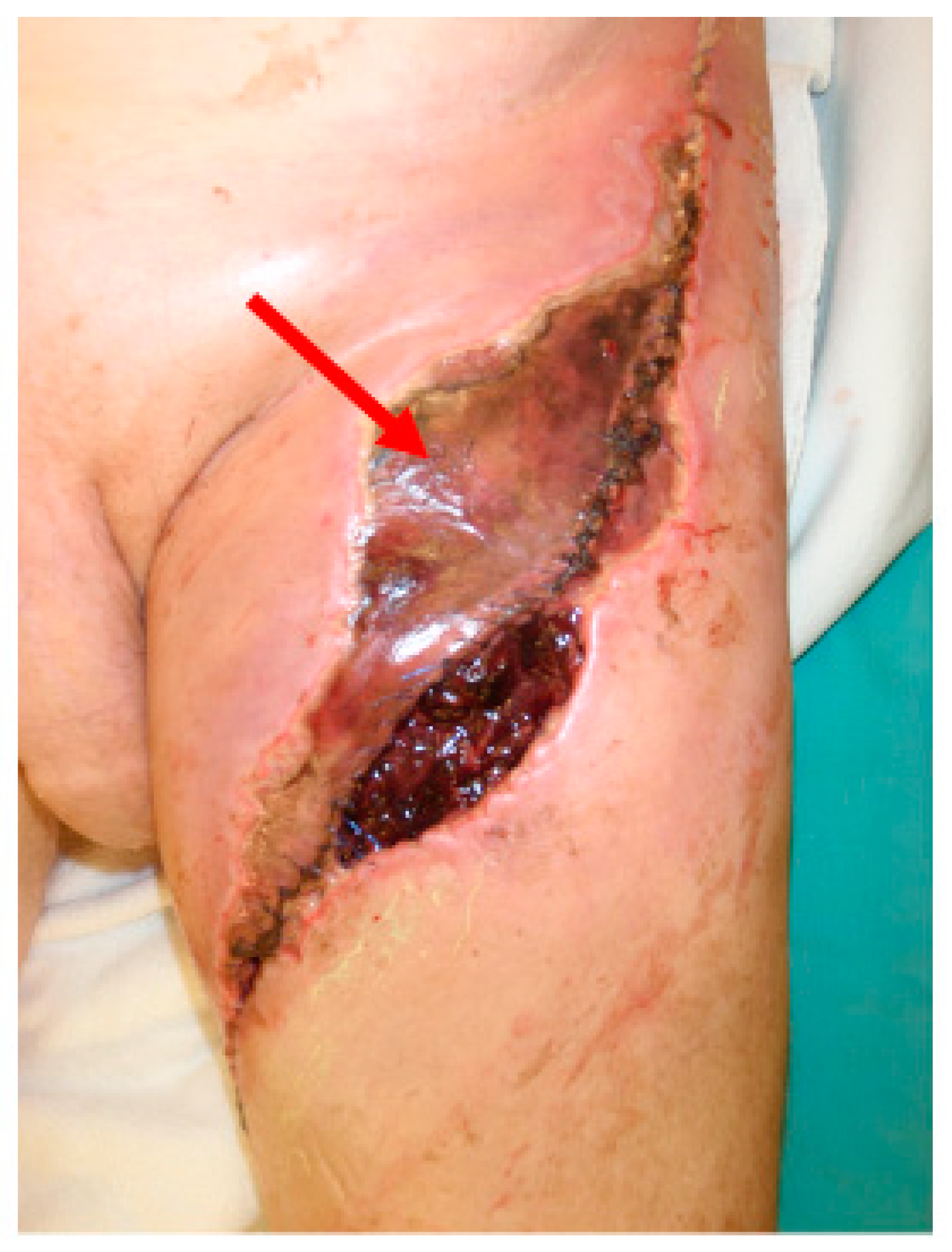 Cancers 12 02258 g001