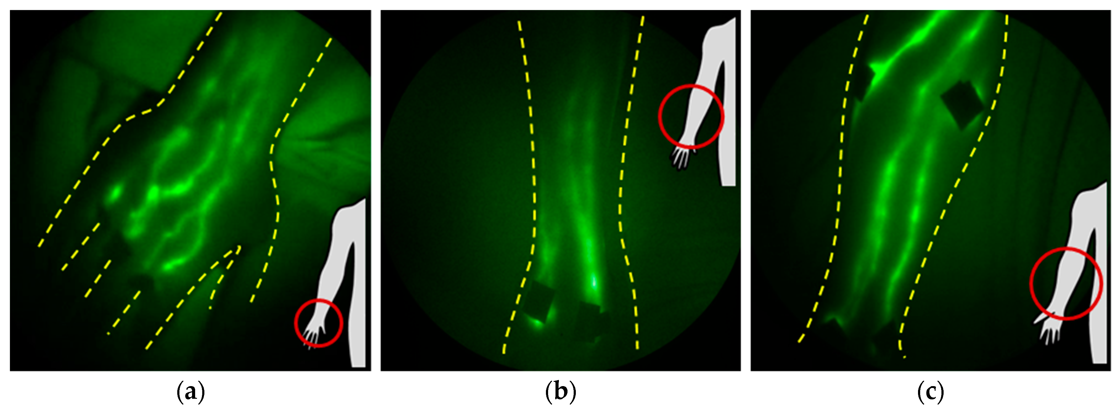 Cancers 12 02280 g004a Cancers 12 02280 g004a