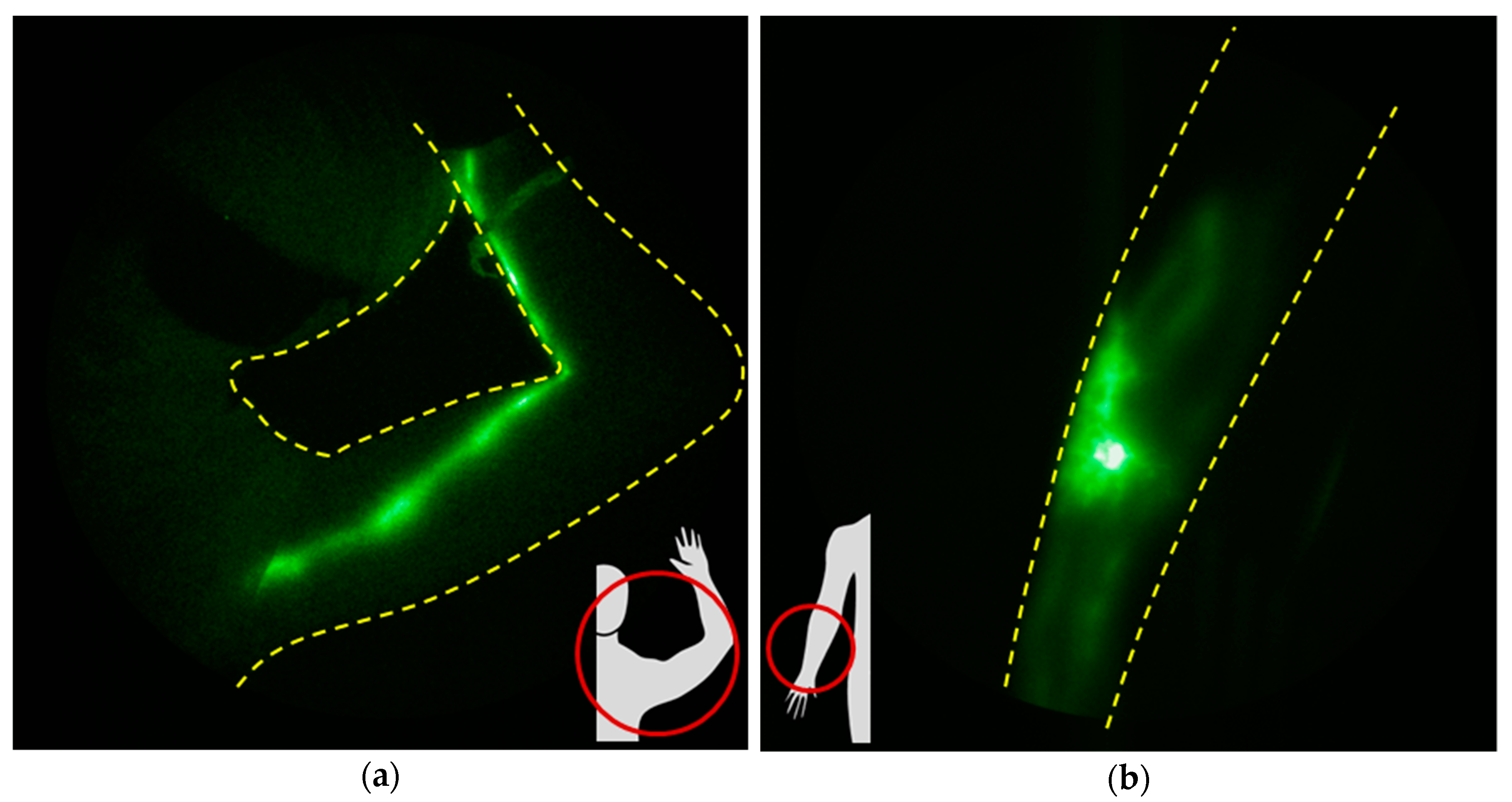 Cancers 12 02280 g007 Cancers 12 02280 g007
