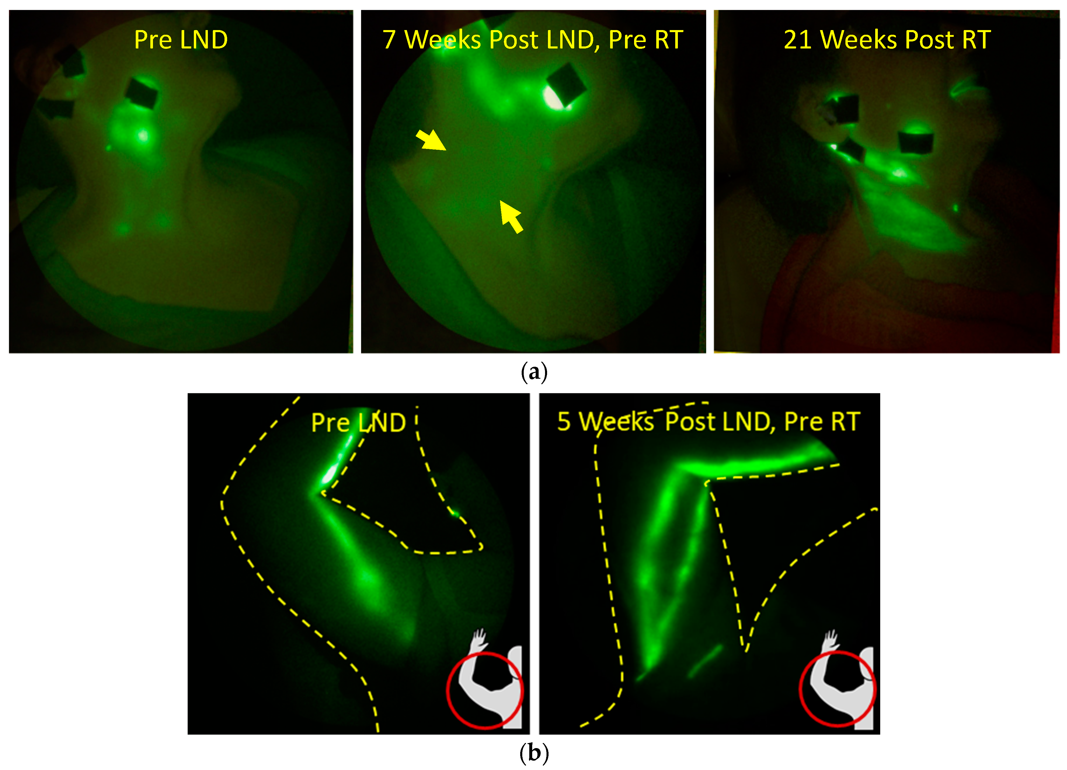 Cancers 12 02280 g008 Cancers 12 02280 g008