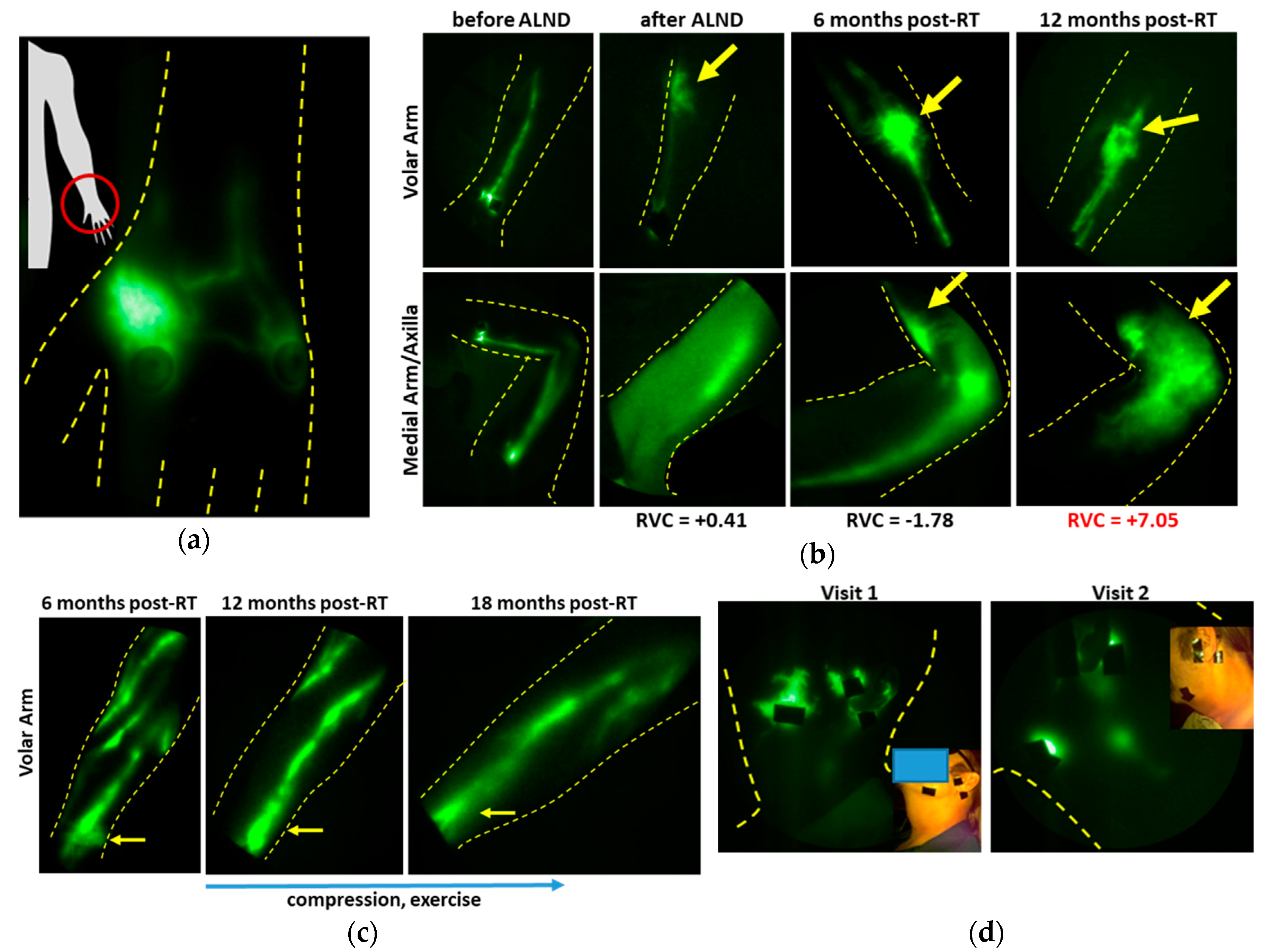 Cancers 12 02280 g009 Cancers 12 02280 g009