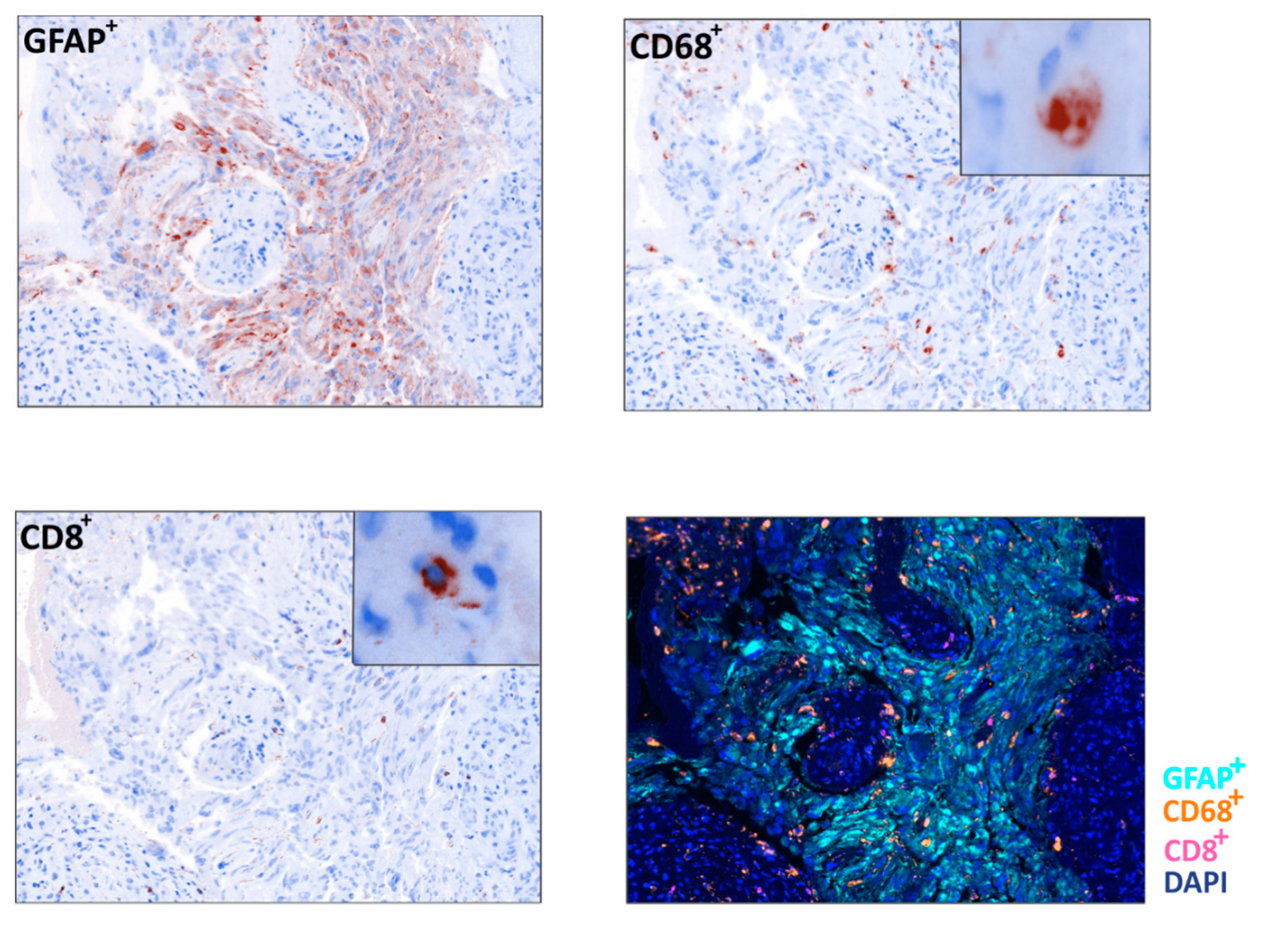 Cancers 12 02283 g004 Cancers 12 02283 g004