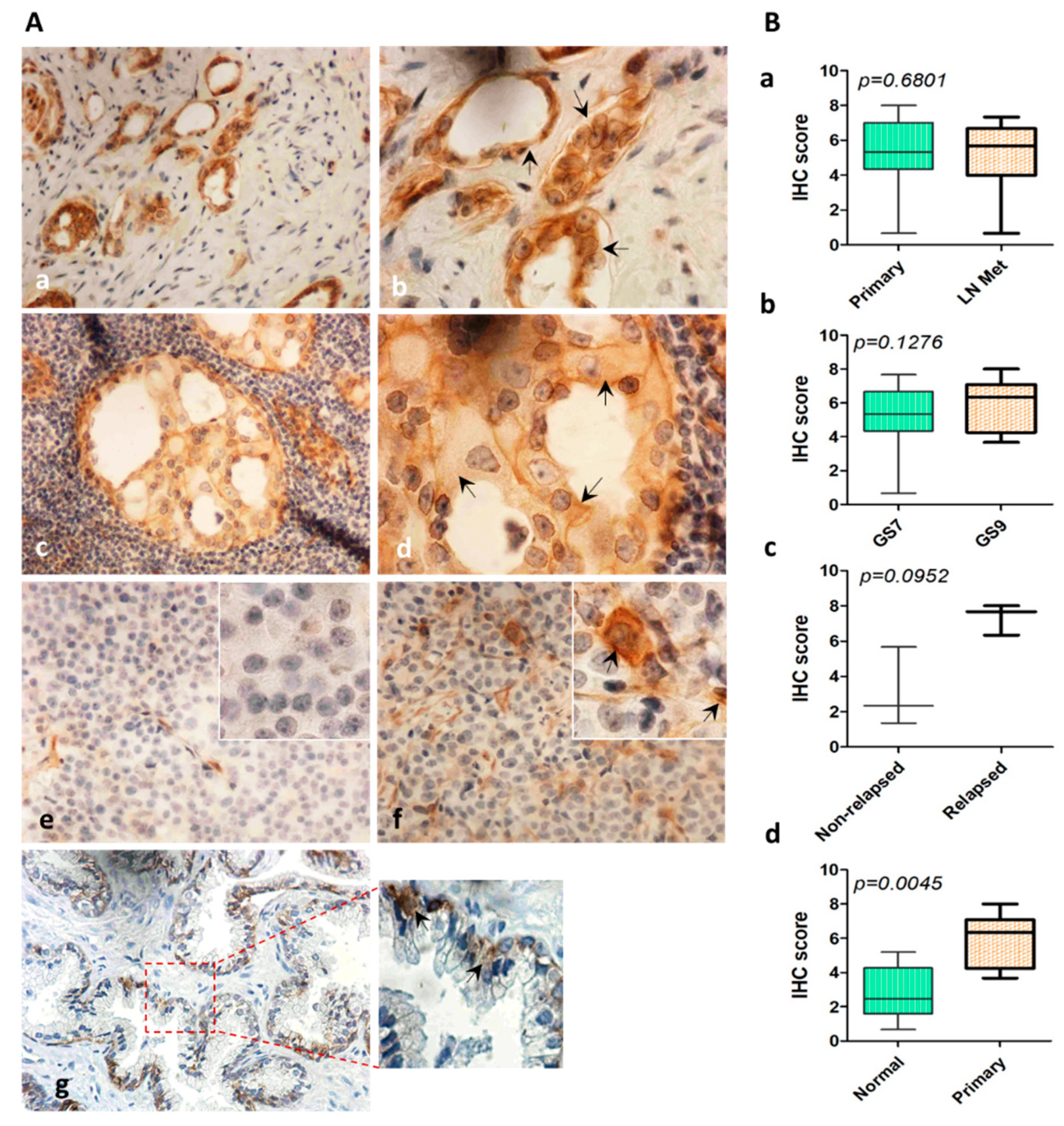 Cancers 12 02300 g006 Cancers 12 02300 g006