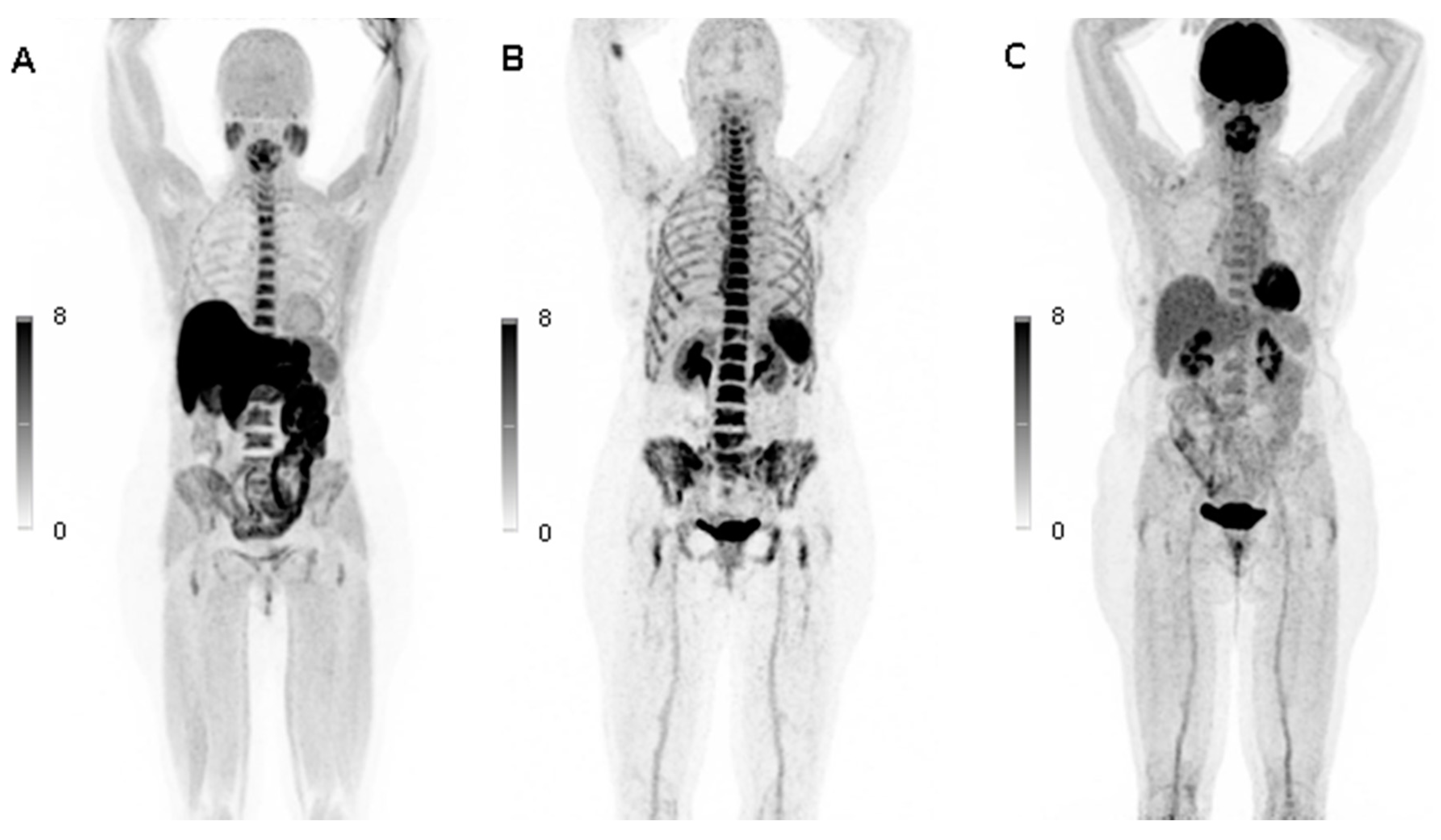 Cancers 12 02333 g005