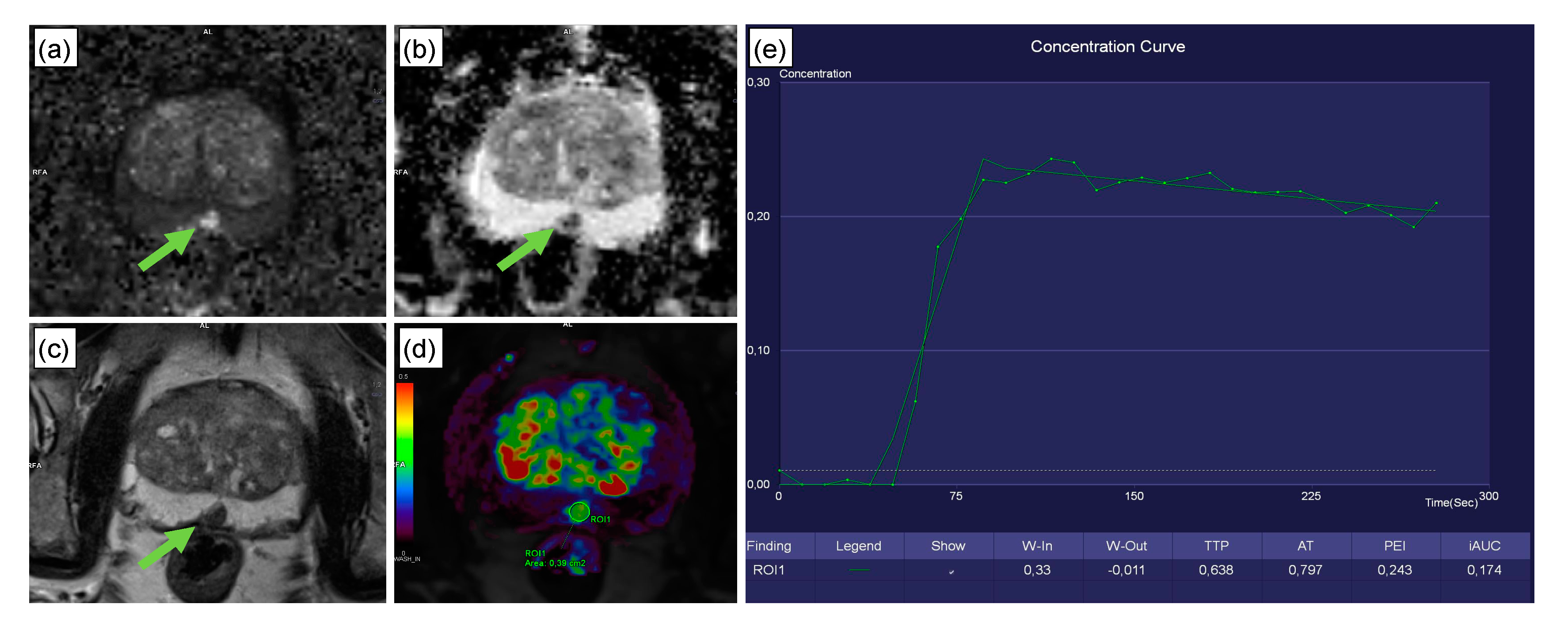 Cancers 12 02366 g004