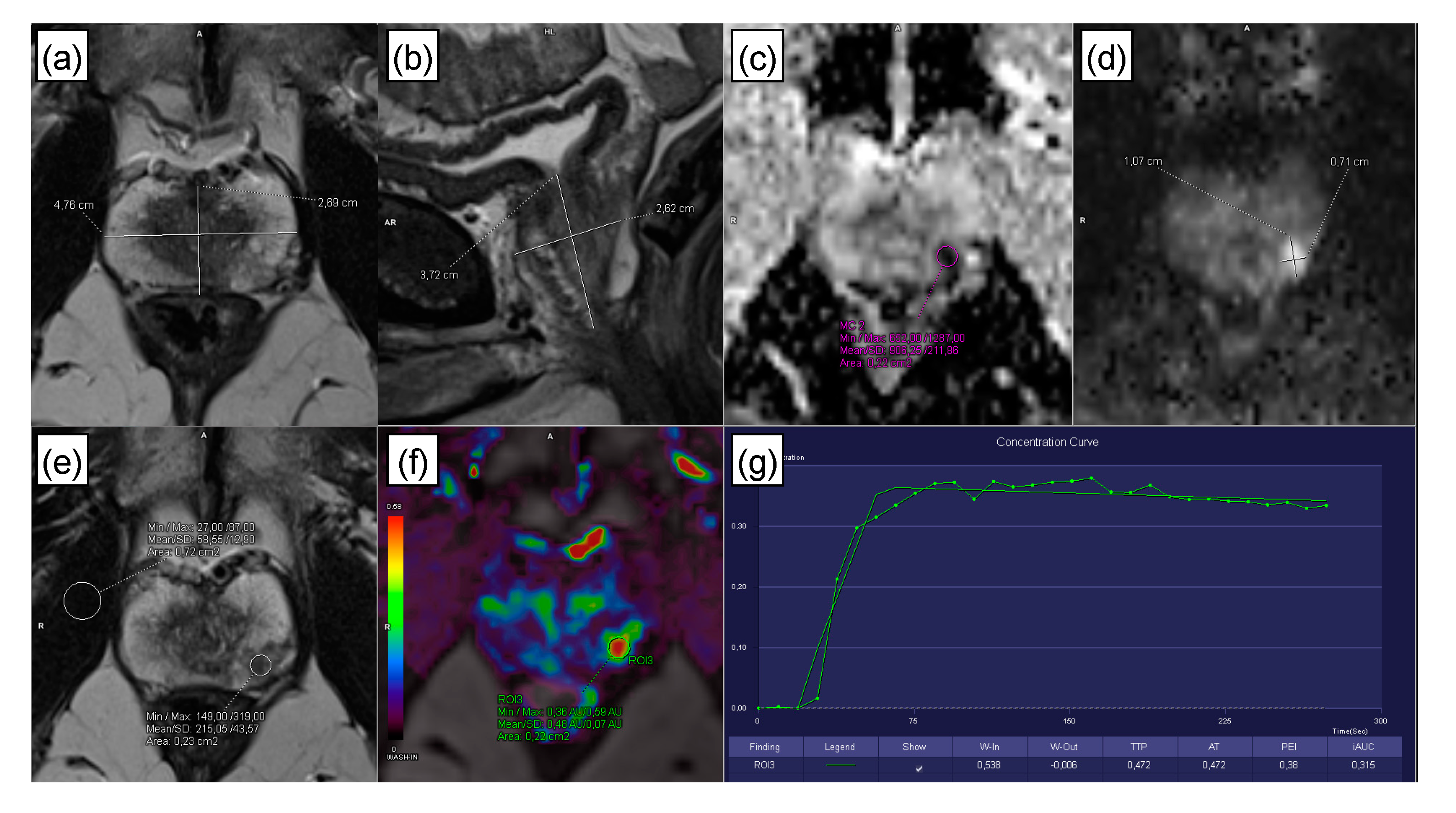 Cancers 12 02366 g006