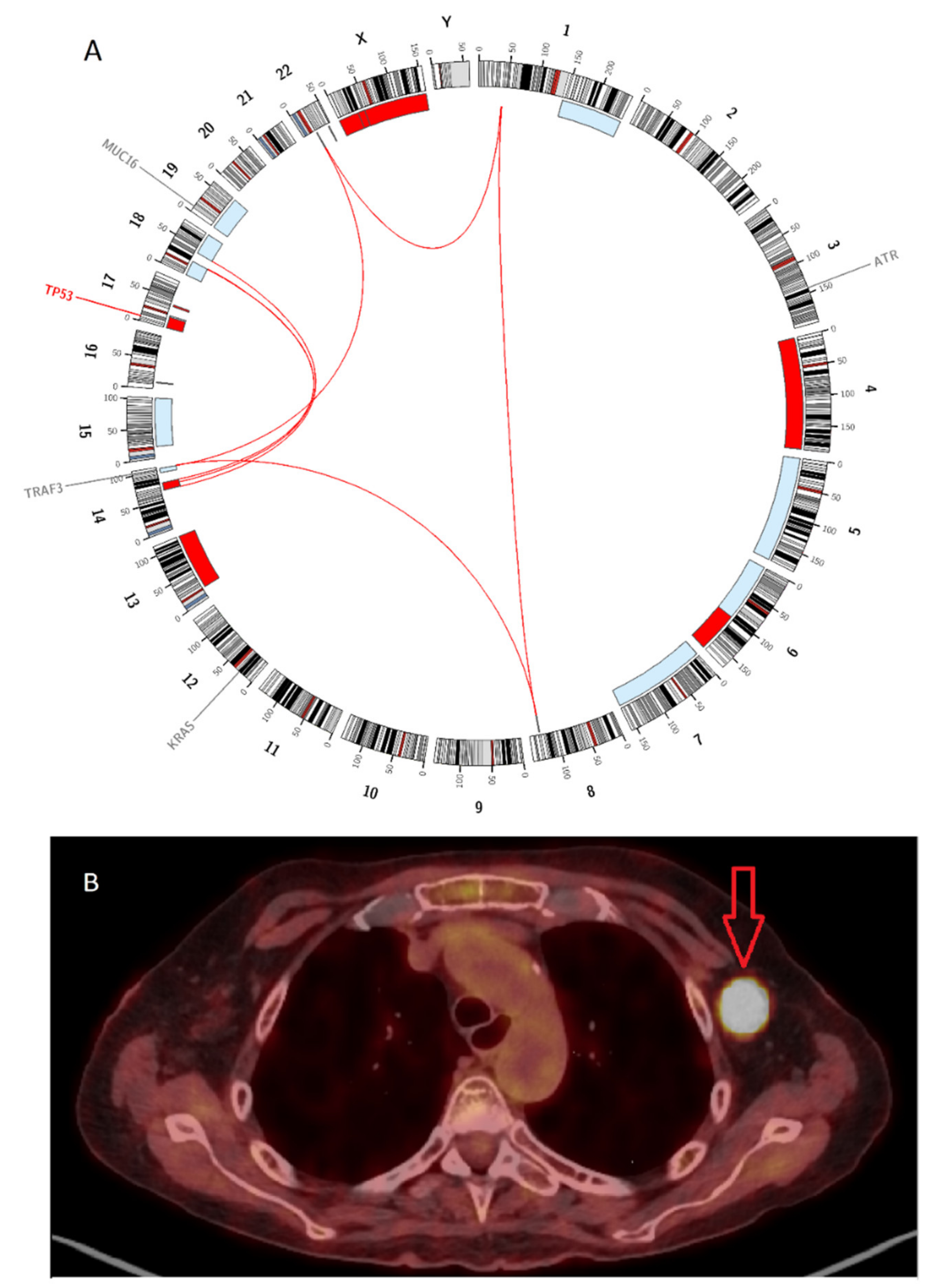 Cancers 12 02399 g004